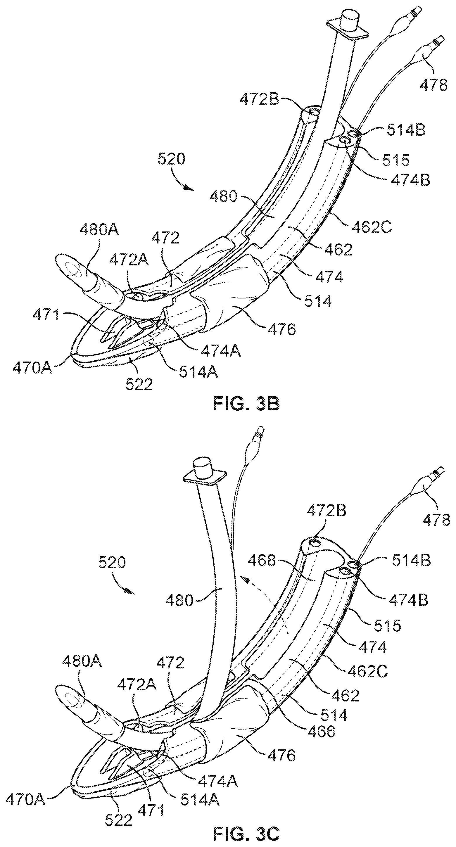 Patent US12569314 Figure 11 – Medical devices for airway management and methods of placement