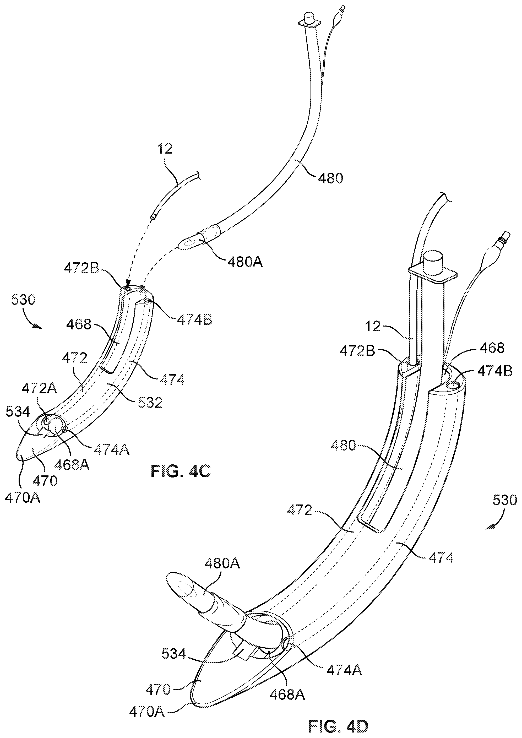 Patent US12569314 Figure 13 – Medical devices for airway management and methods of placement
