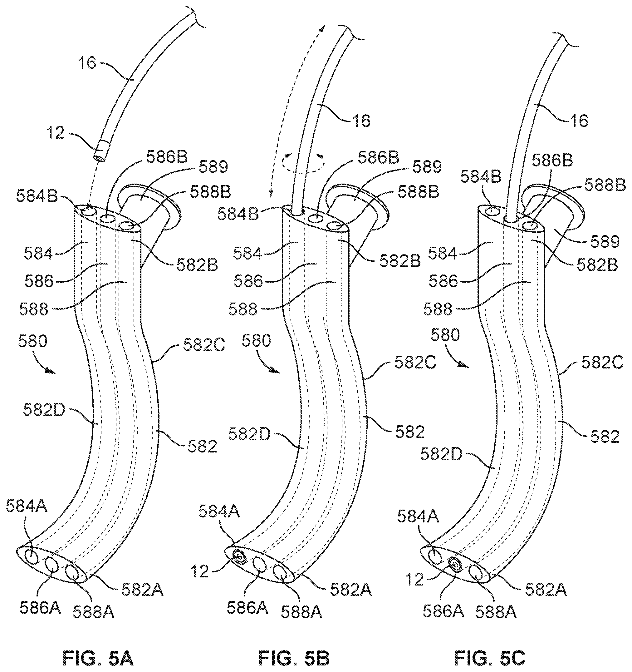 Patent US12569314 Figure 17 – Medical devices for airway management and methods of placement