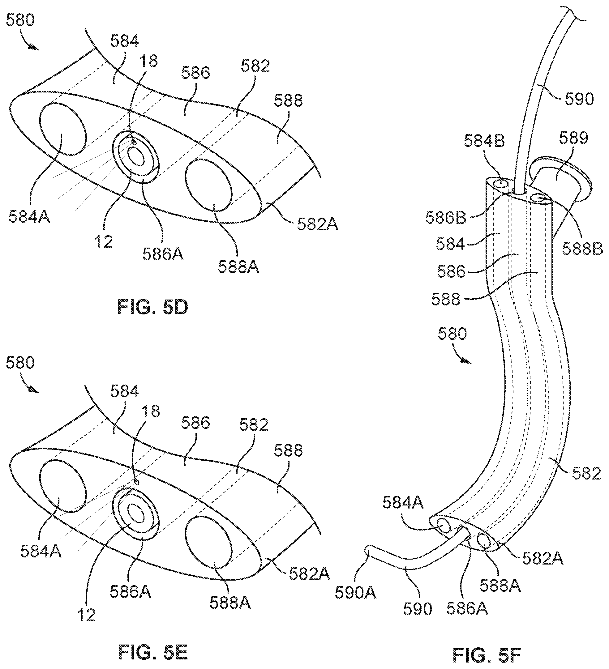 Patent US12569314 Figure 18 – Medical devices for airway management and methods of placement