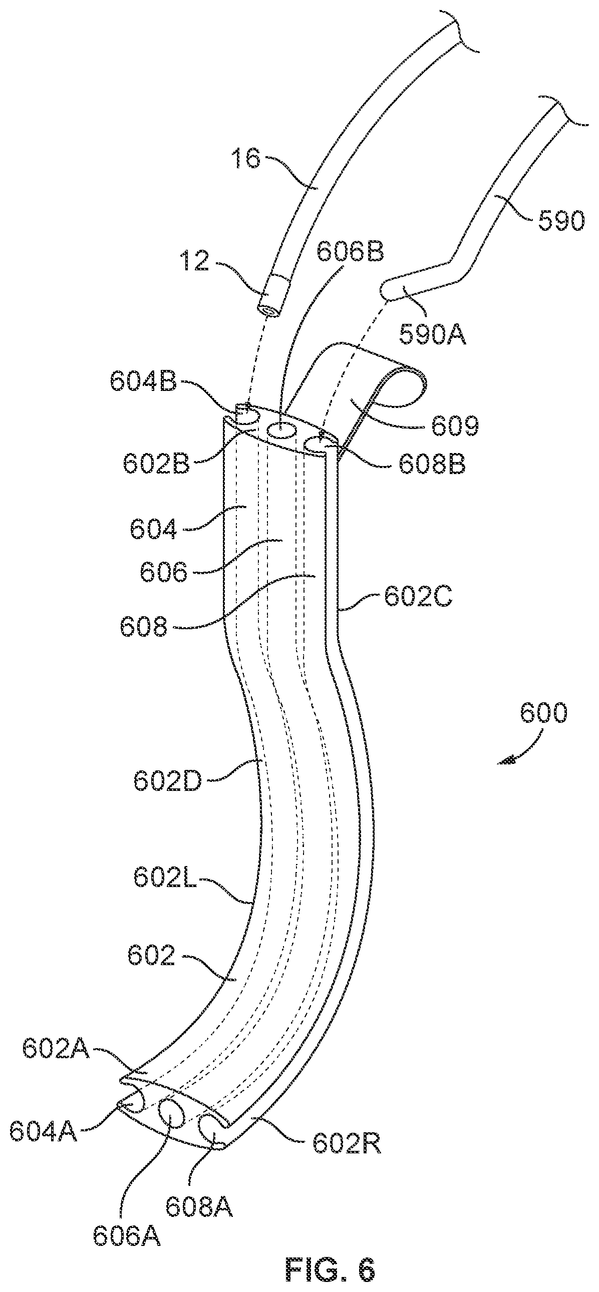 Patent US12569314 Figure 19 – Medical devices for airway management and methods of placement