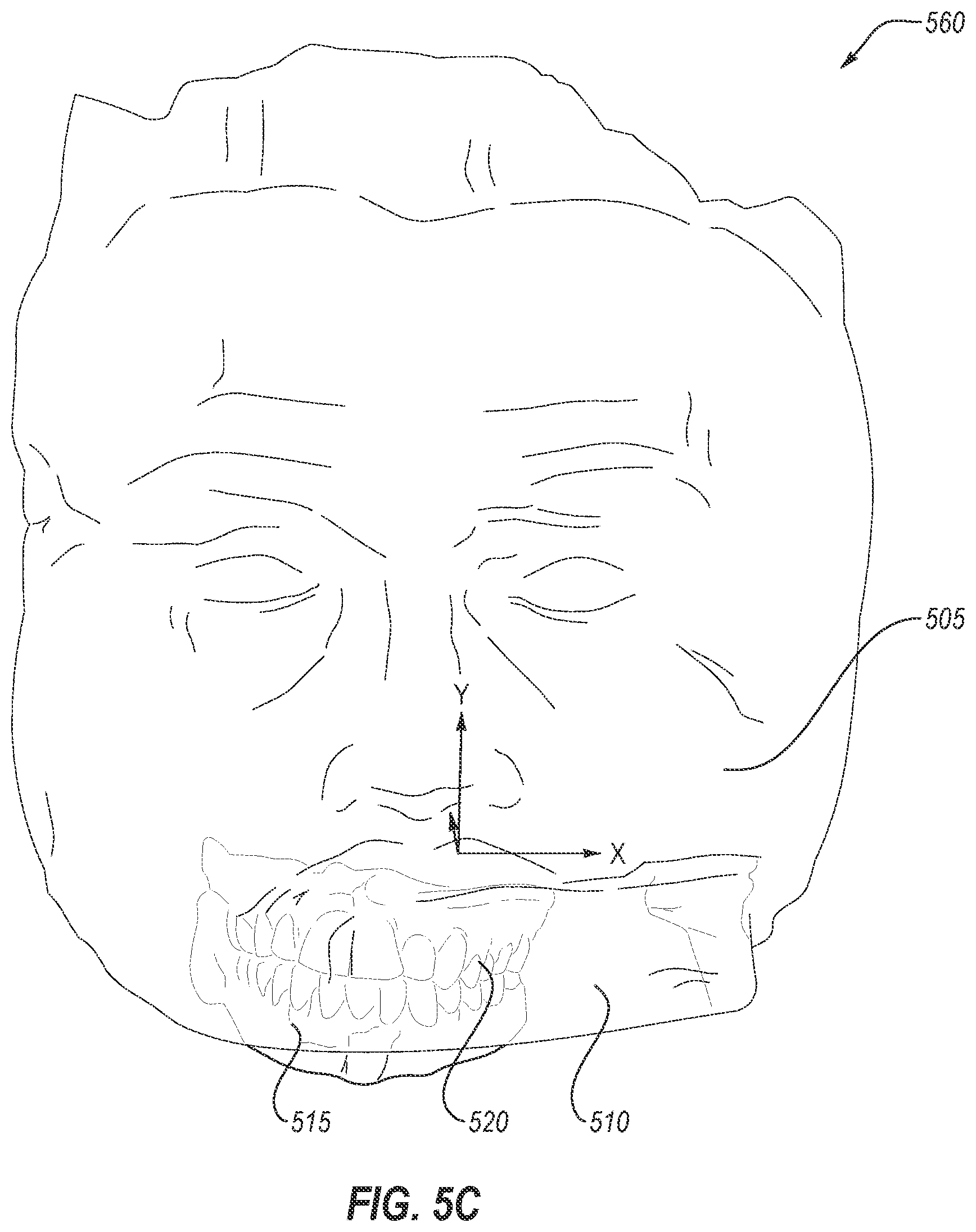 Patent US12569319 Figure 8 – Combined face scanning and intraoral scanning