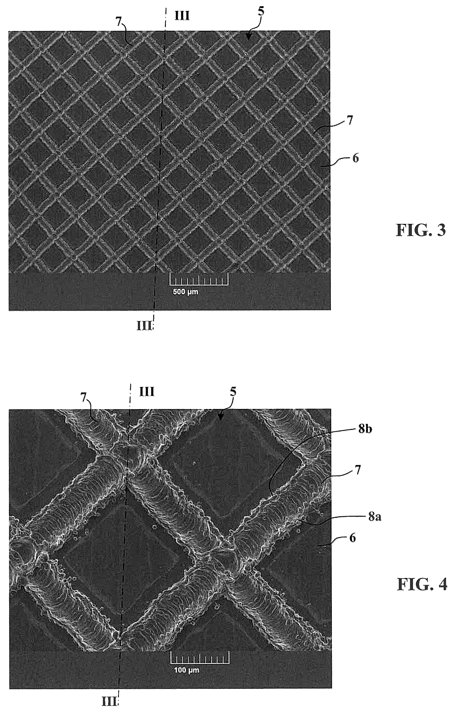 Patent US12569320 Figure 2 – Method for manufacturing an abutment for receiving a dental prosthesis