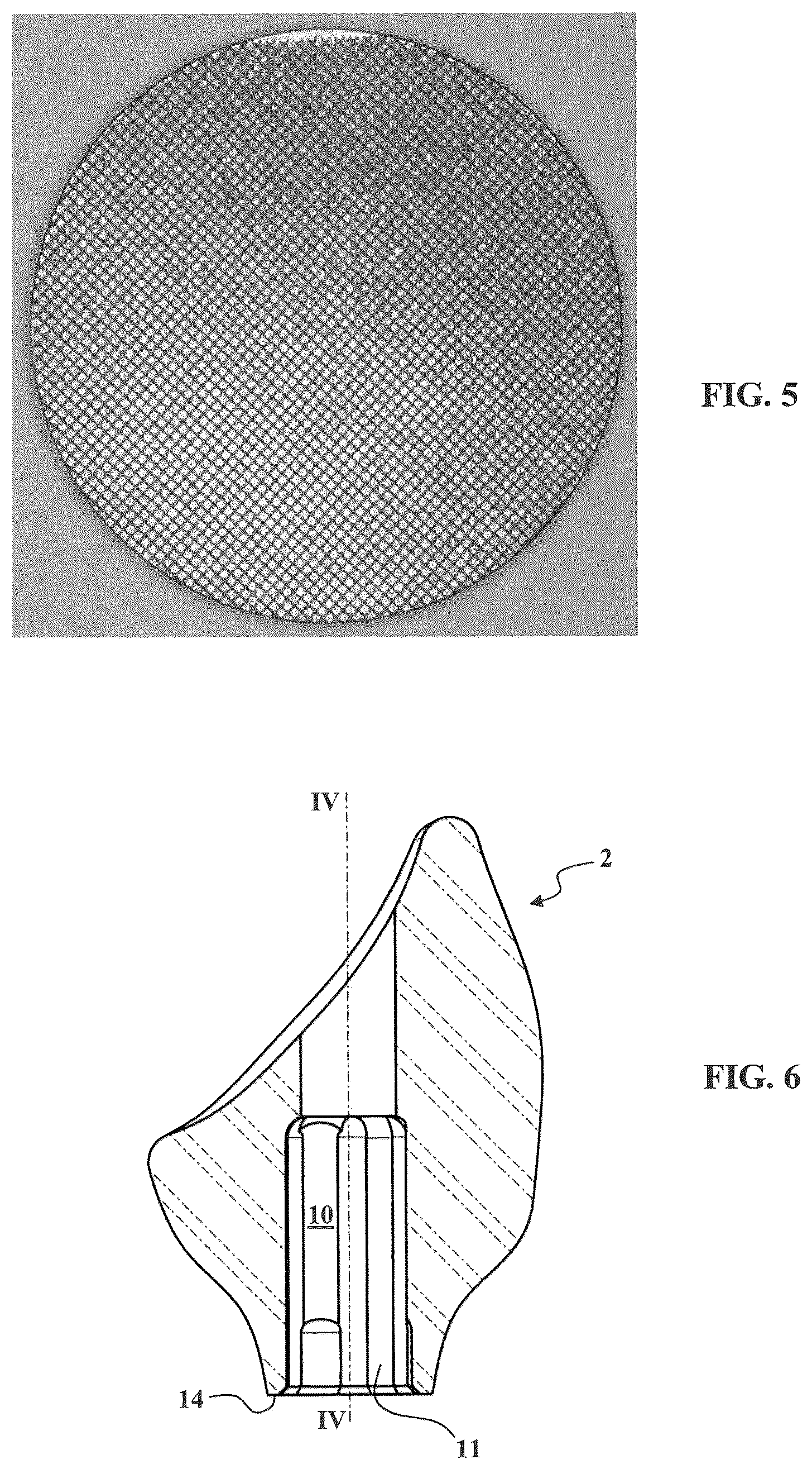 Patent US12569320 Figure 3 – Method for manufacturing an abutment for receiving a dental prosthesis