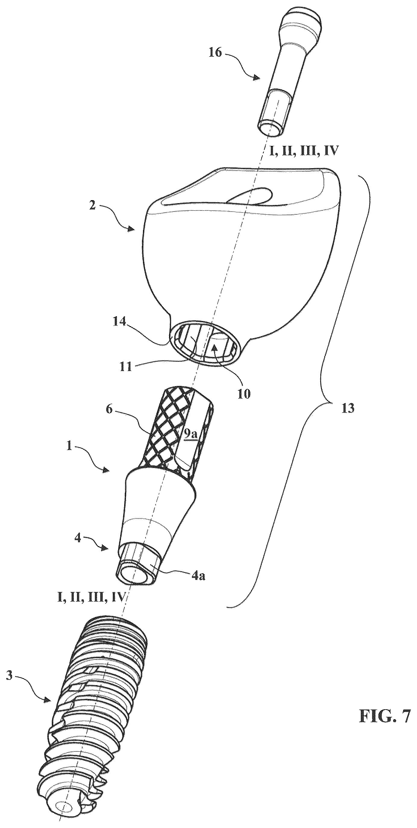 Patent US12569320 Figure 4 – Method for manufacturing an abutment for receiving a dental prosthesis