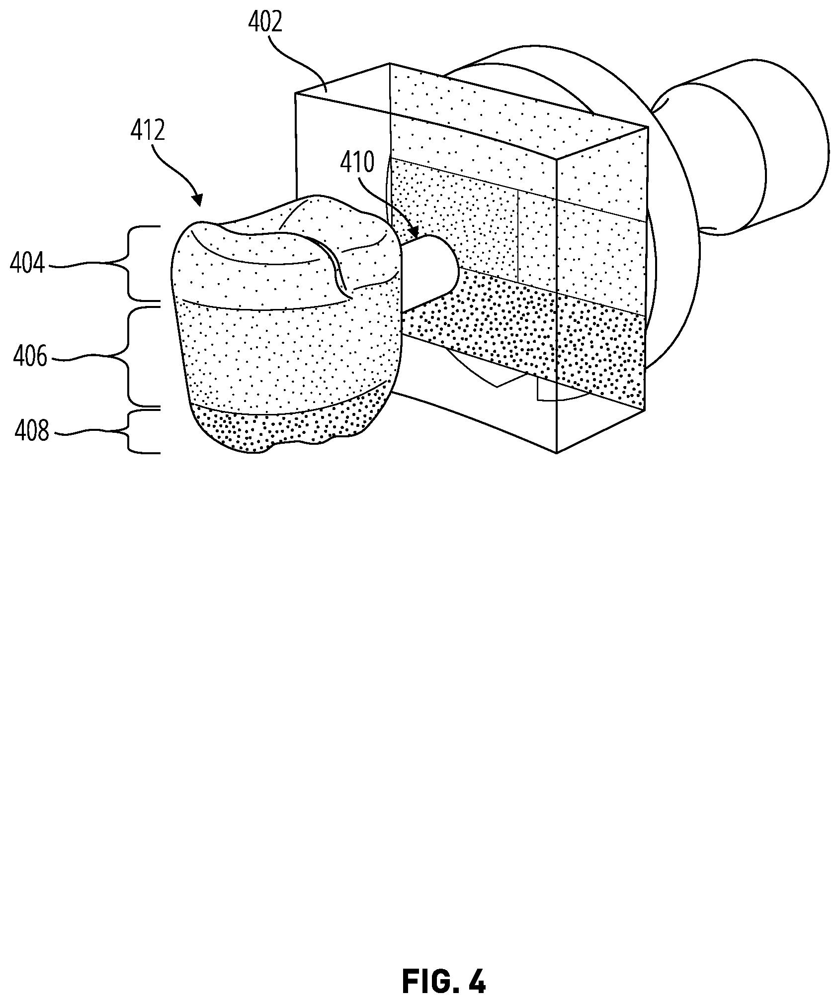 Patent US12569321 Figure 4 – Proposing dental restoration material parameters