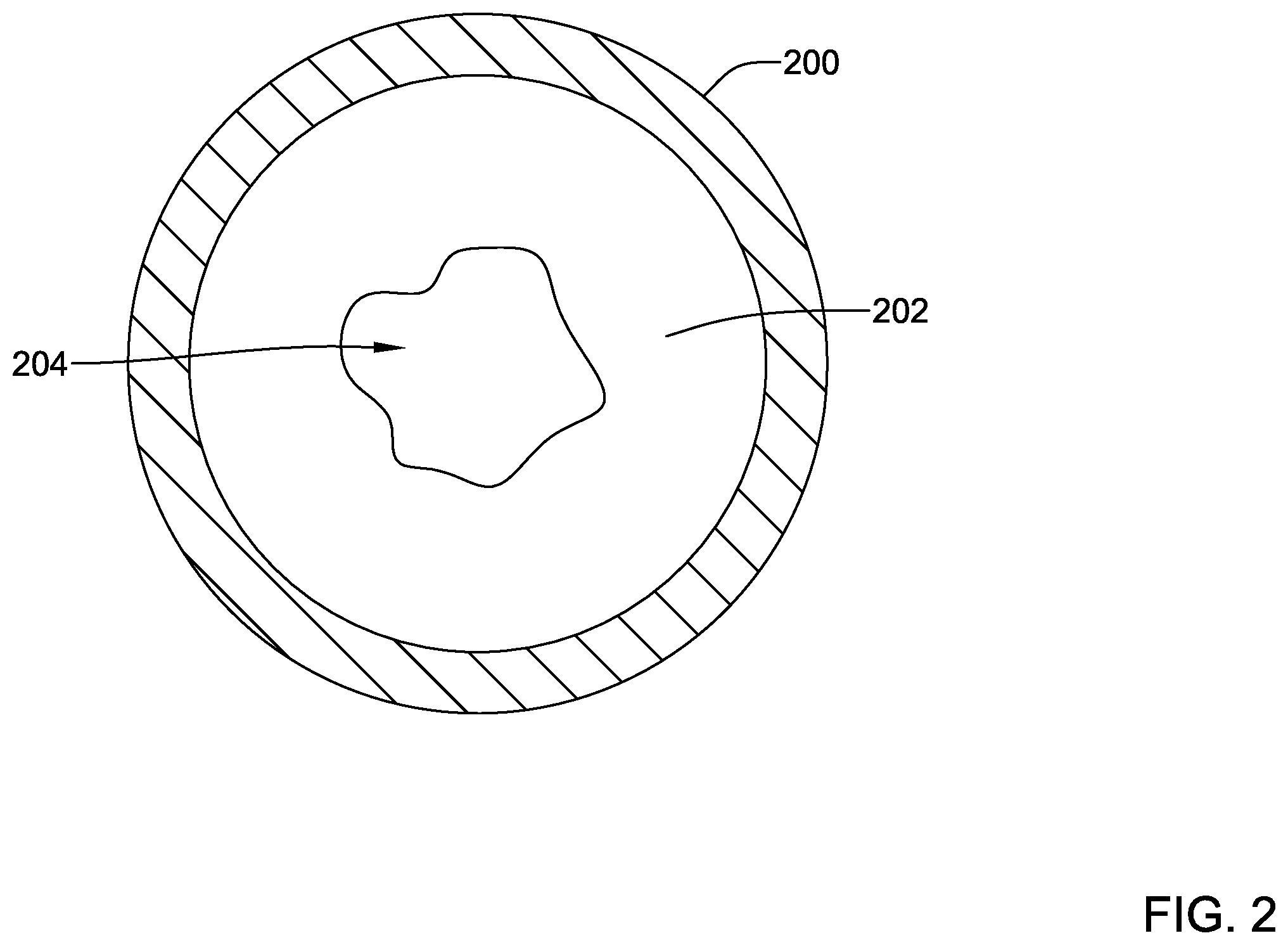 Patent US12569325 Figure 2 – Device for use with body tissue sphincters