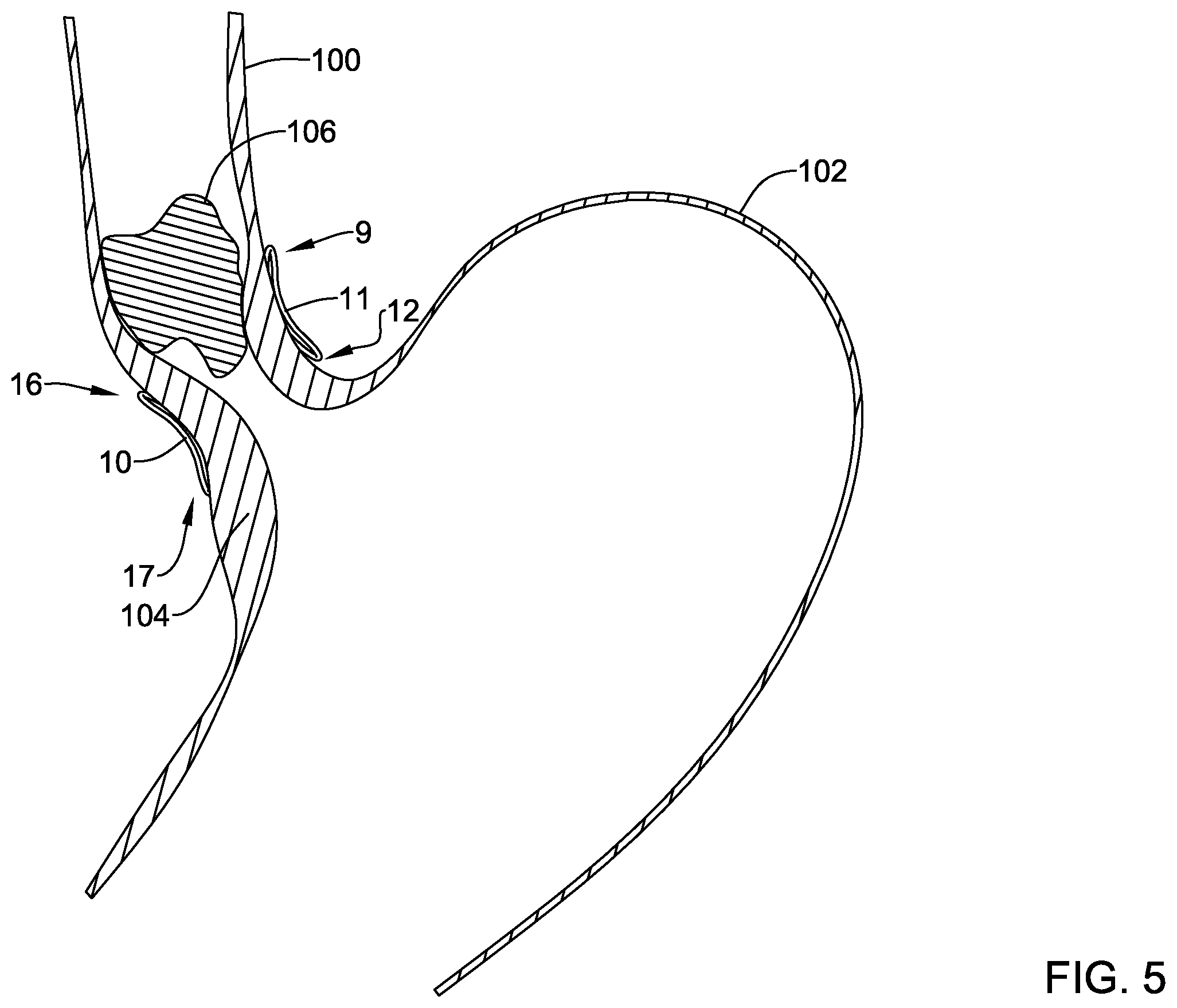 Patent US12569325 Figure 5 – Device for use with body tissue sphincters