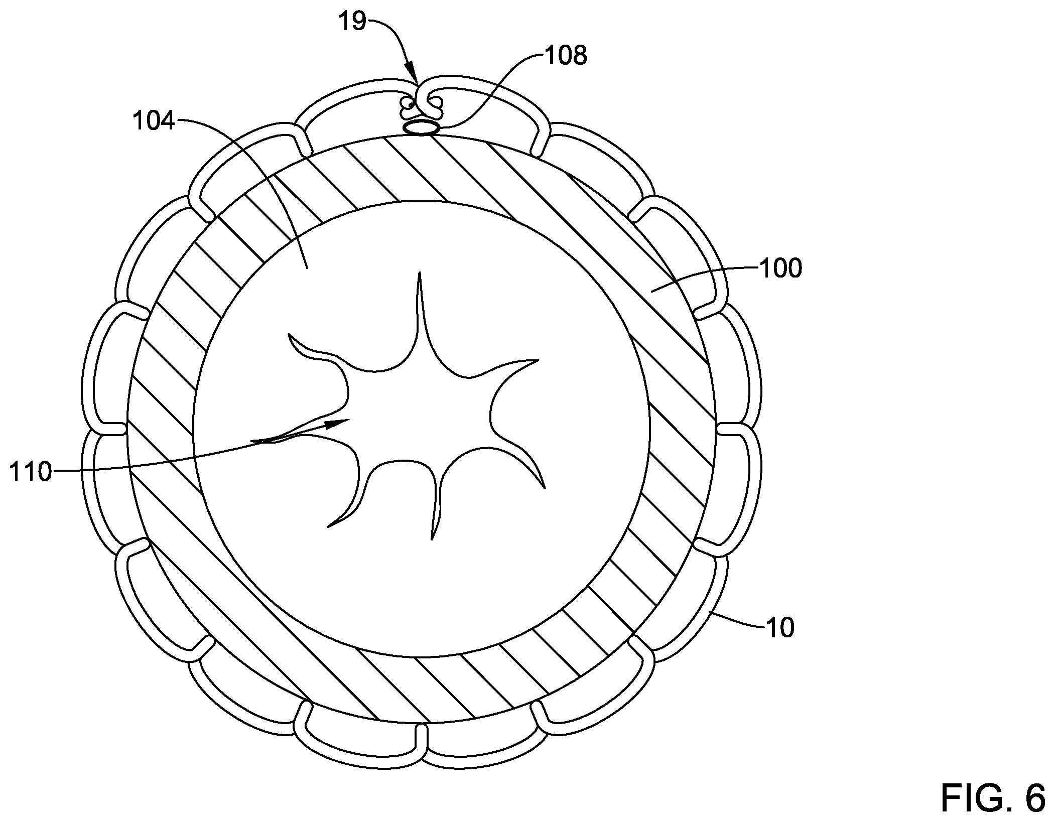 Patent US12569325 Figure 6 – Device for use with body tissue sphincters