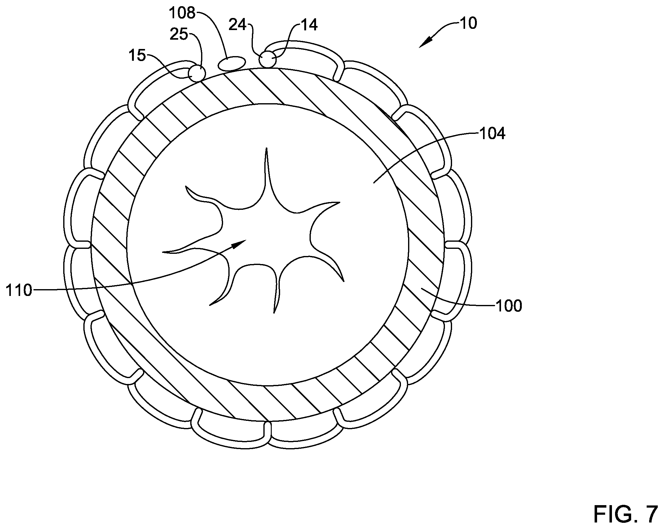 Patent US12569325 Figure 7 – Device for use with body tissue sphincters