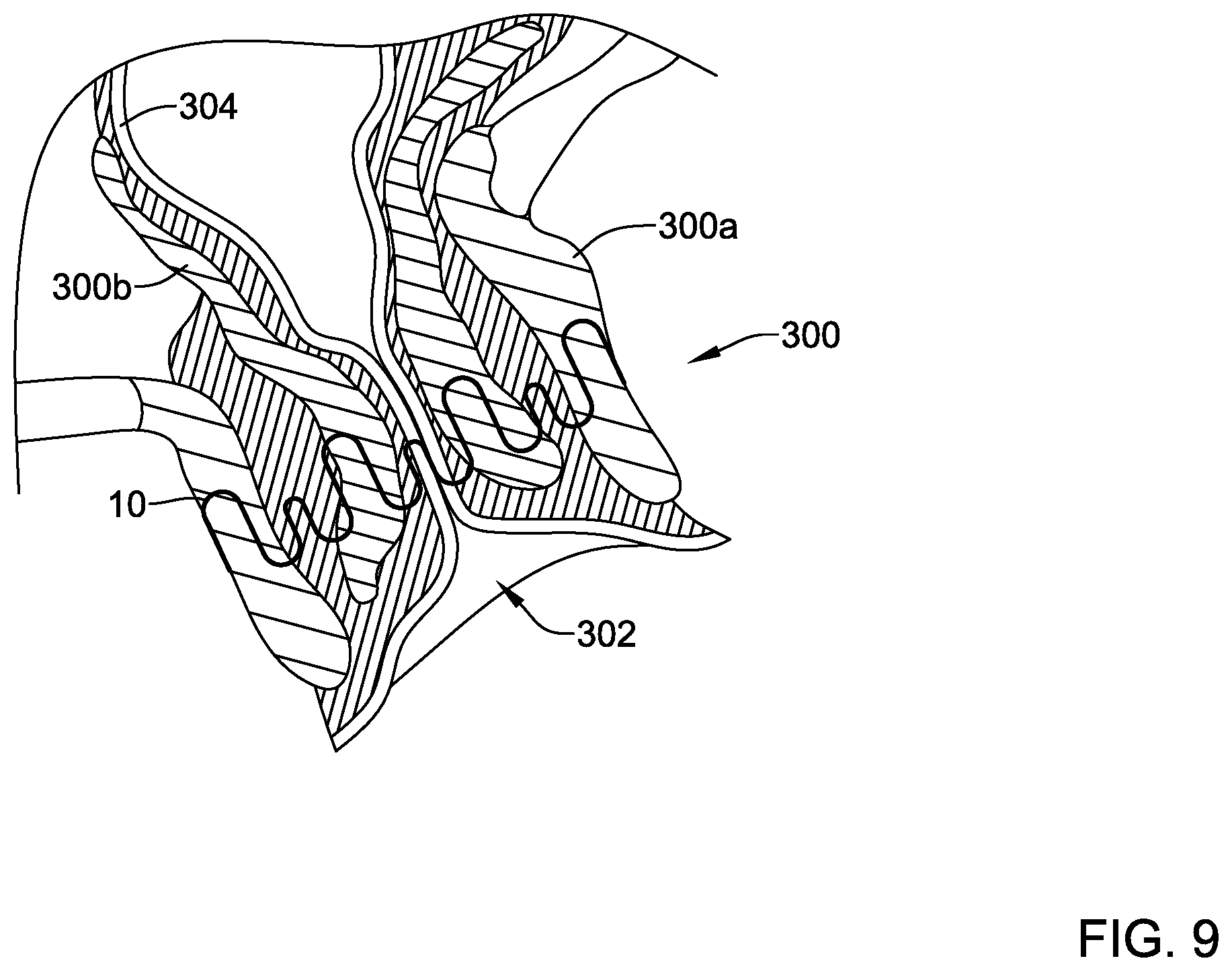 Patent US12569325 Figure 9 – Device for use with body tissue sphincters