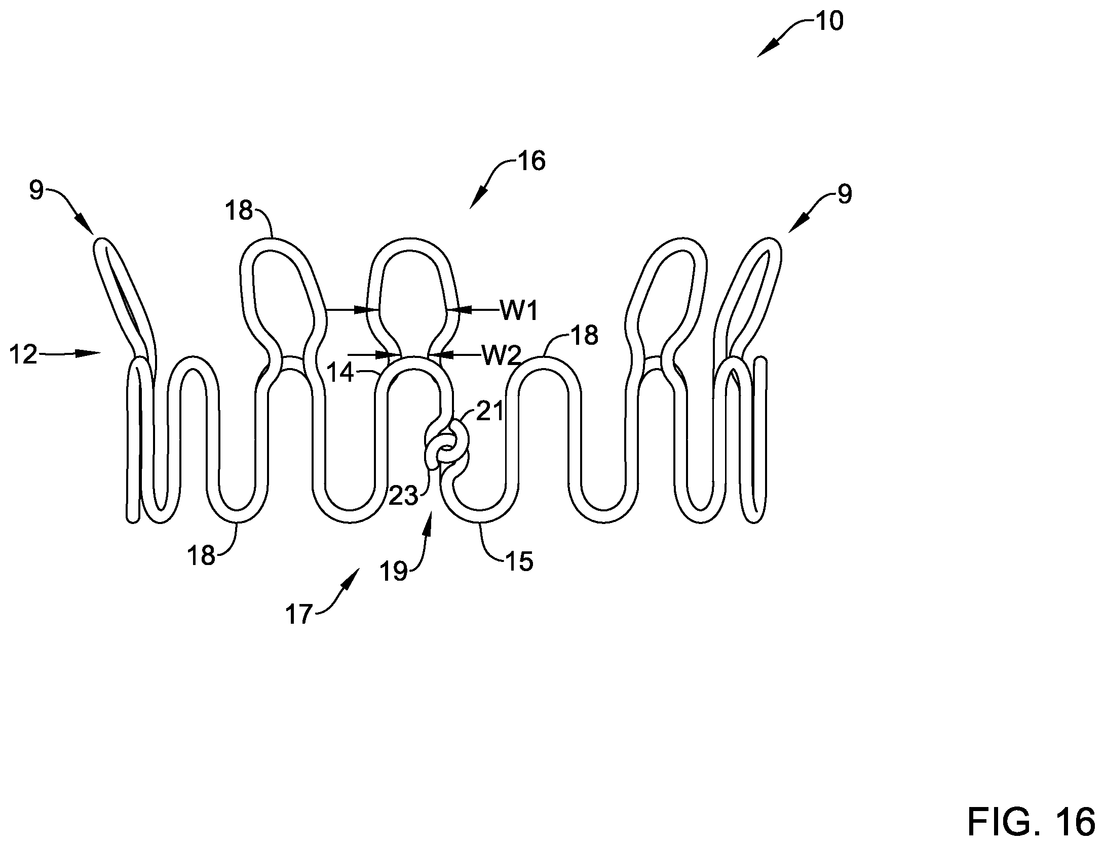 Patent US12569325 Figure 16 – Device for use with body tissue sphincters