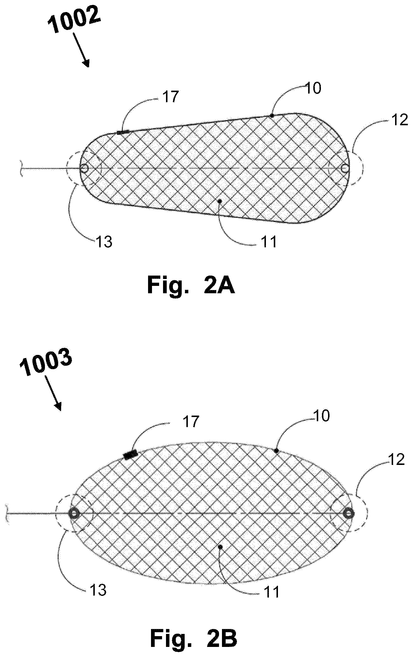 Patent US12569328 Figure 2 – Device for filtering embolic material in a vascular system