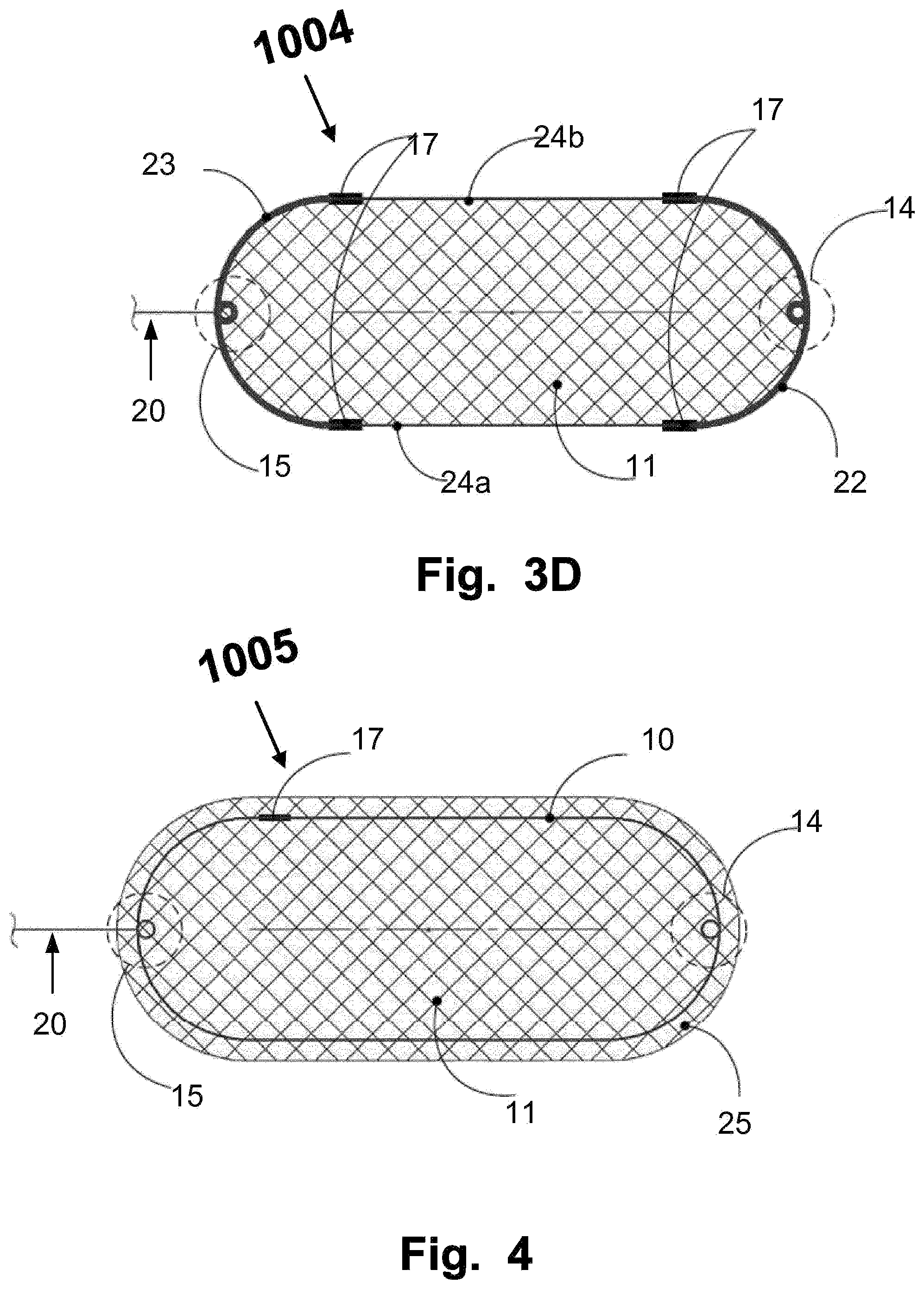Patent US12569328 Figure 4 – Device for filtering embolic material in a vascular system