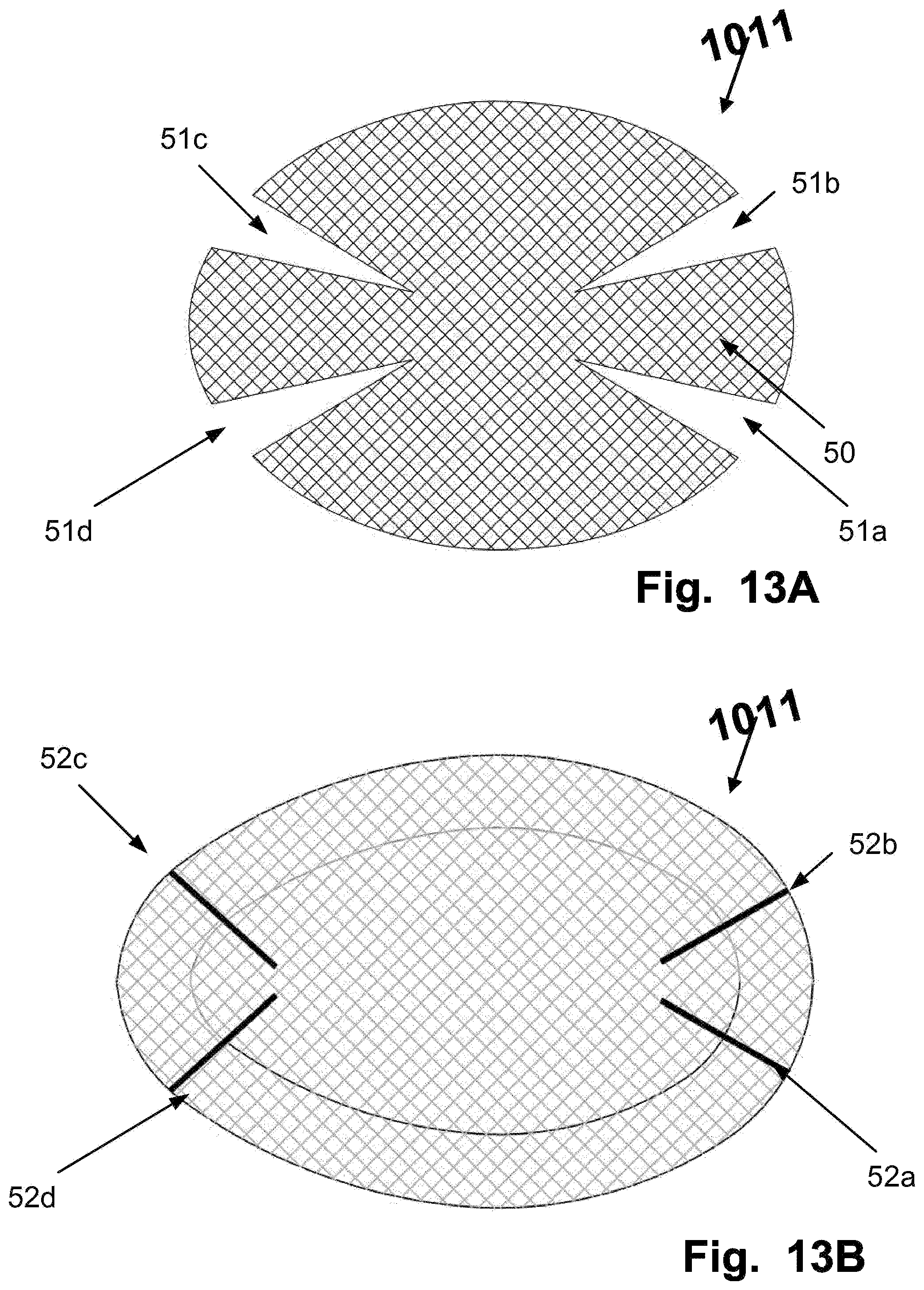 Patent US12569328 Figure 14 – Device for filtering embolic material in a vascular system