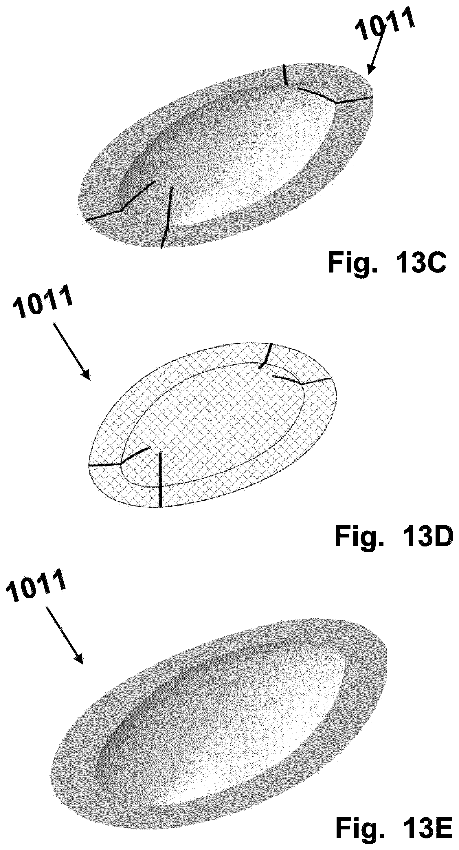 Patent US12569328 Figure 15 – Device for filtering embolic material in a vascular system