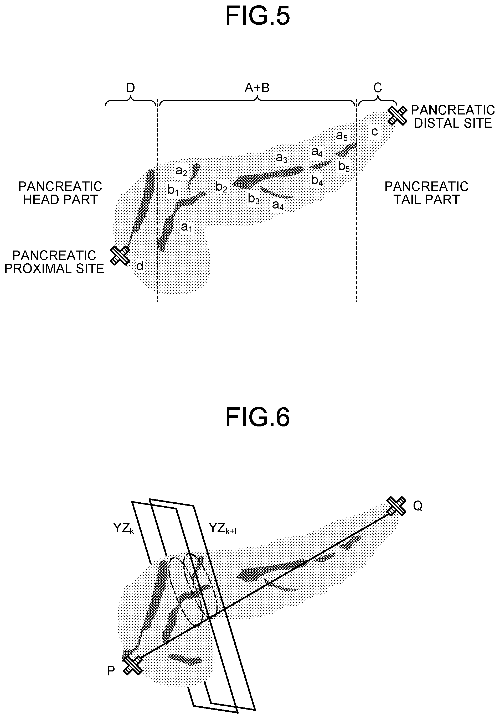 Patent US12569329 Figure 4 – Medical image processing apparatus, medical image processing method, and non-transitory computer-readable storage medium
