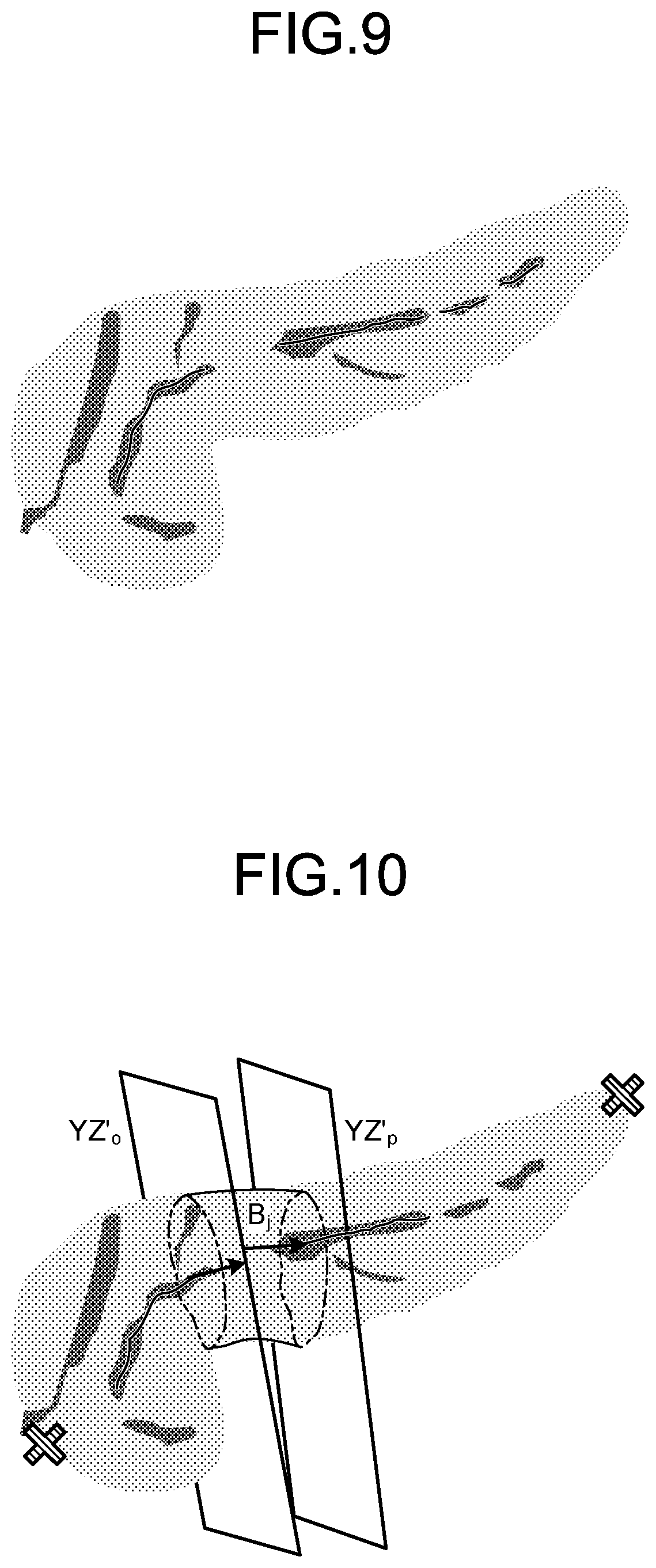 Patent US12569329 Figure 6 – Medical image processing apparatus, medical image processing method, and non-transitory computer-readable storage medium