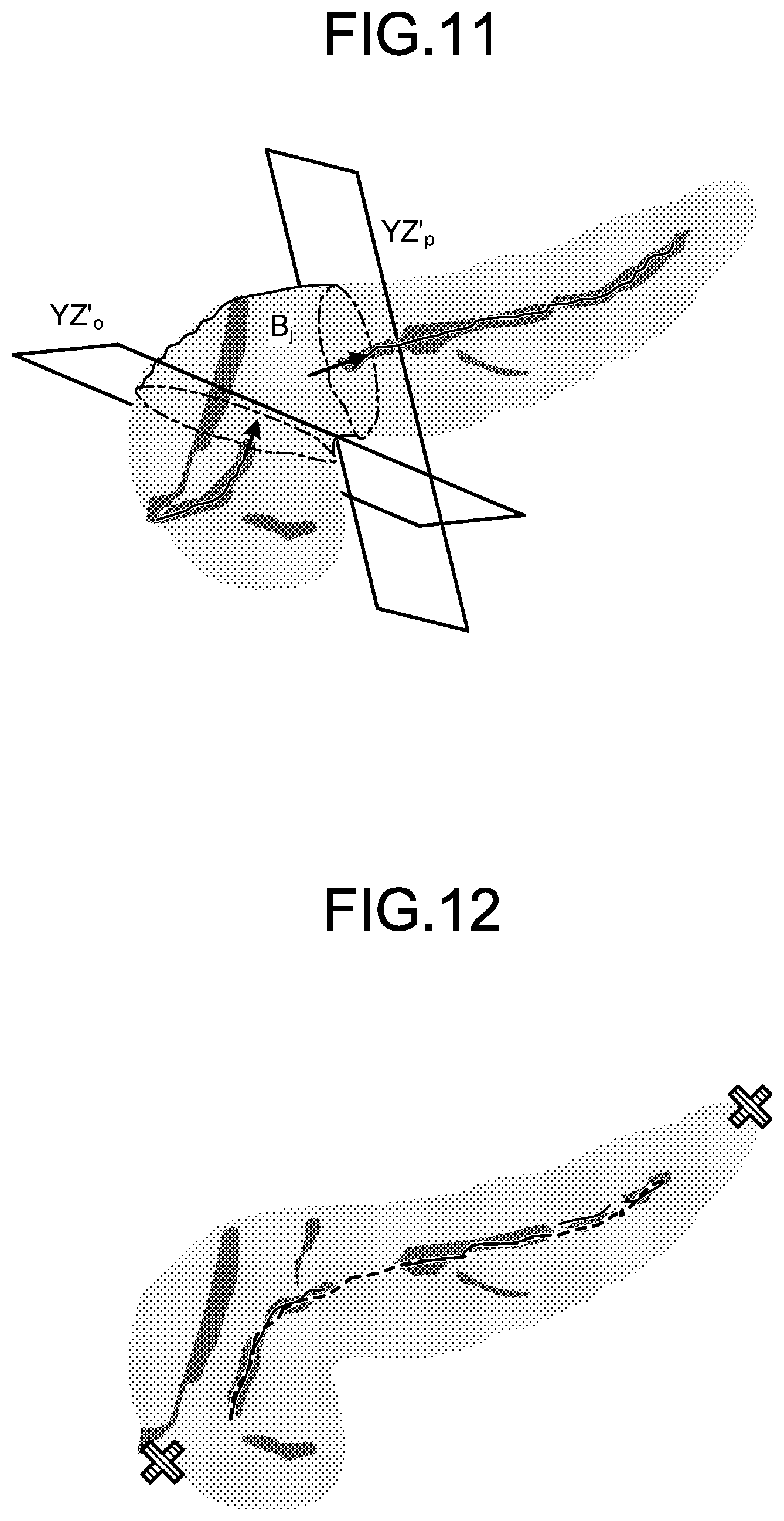 Patent US12569329 Figure 7 – Medical image processing apparatus, medical image processing method, and non-transitory computer-readable storage medium