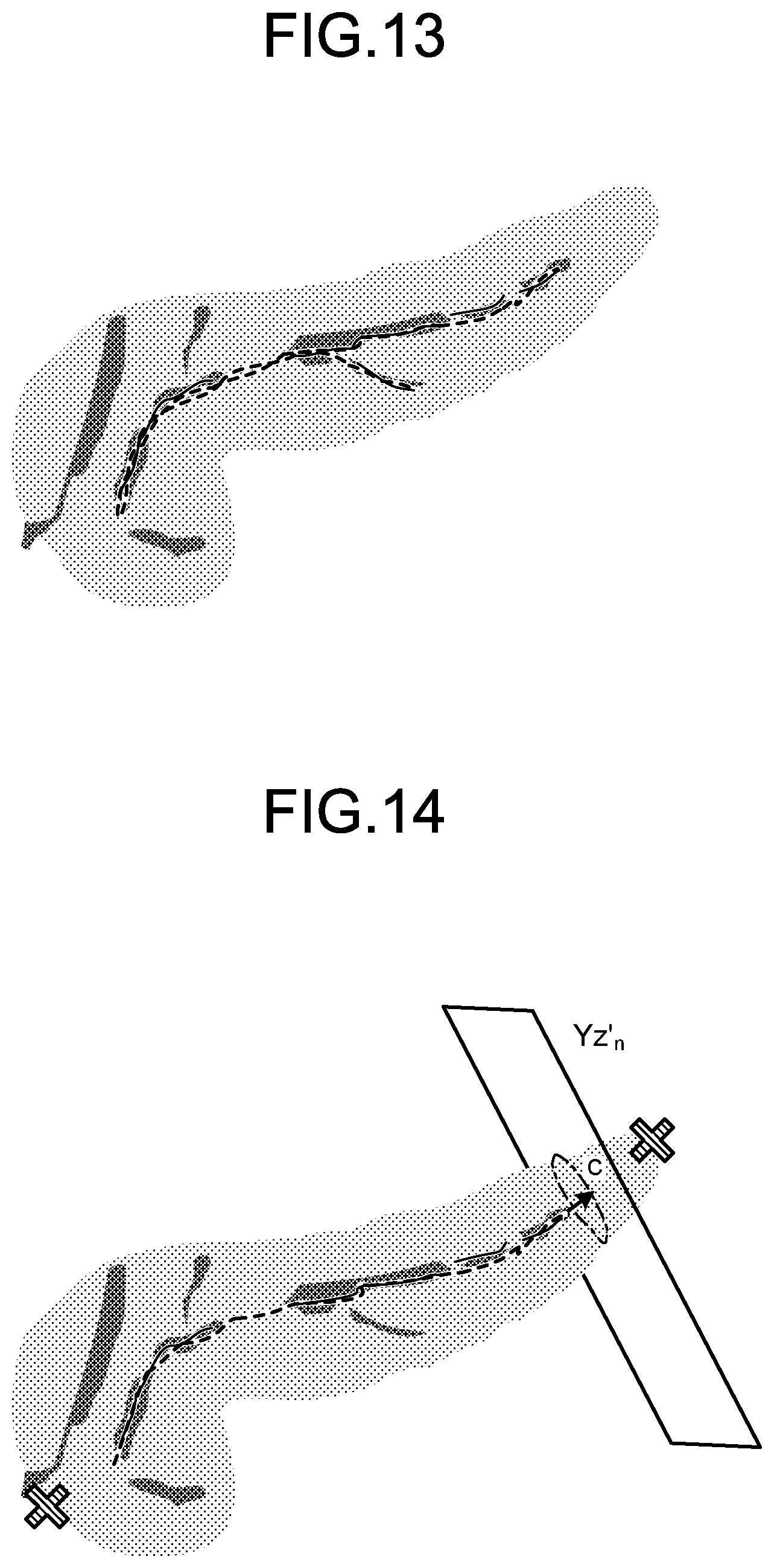 Patent US12569329 Figure 8 – Medical image processing apparatus, medical image processing method, and non-transitory computer-readable storage medium