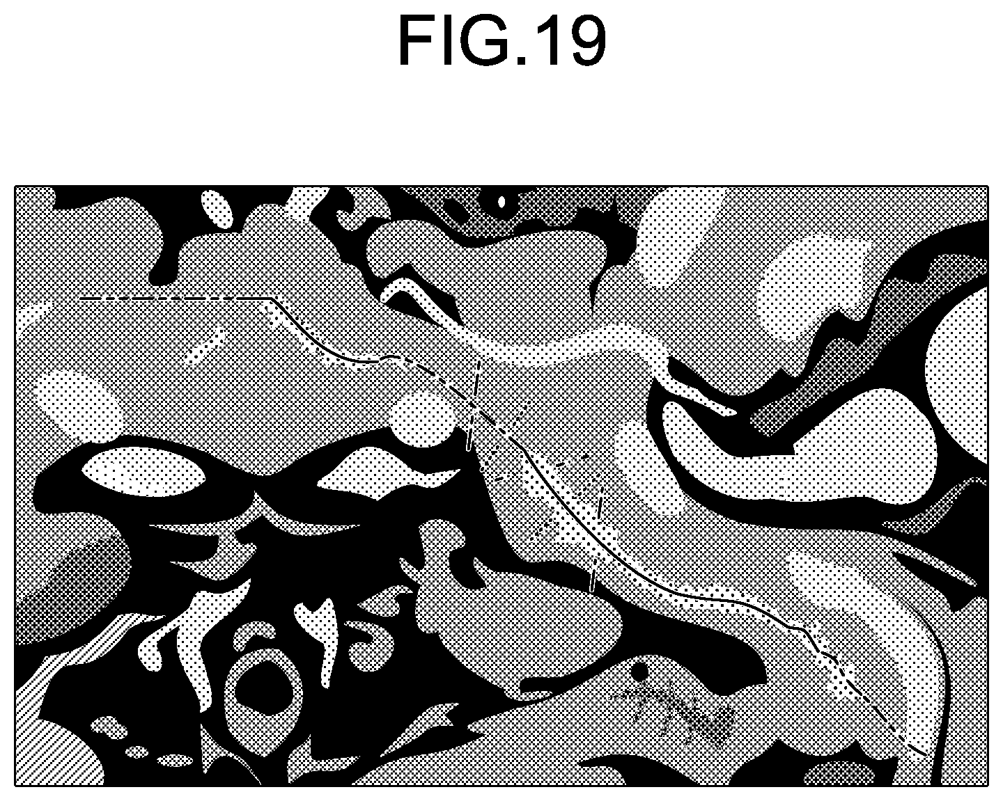 Patent US12569329 Figure 12 – Medical image processing apparatus, medical image processing method, and non-transitory computer-readable storage medium