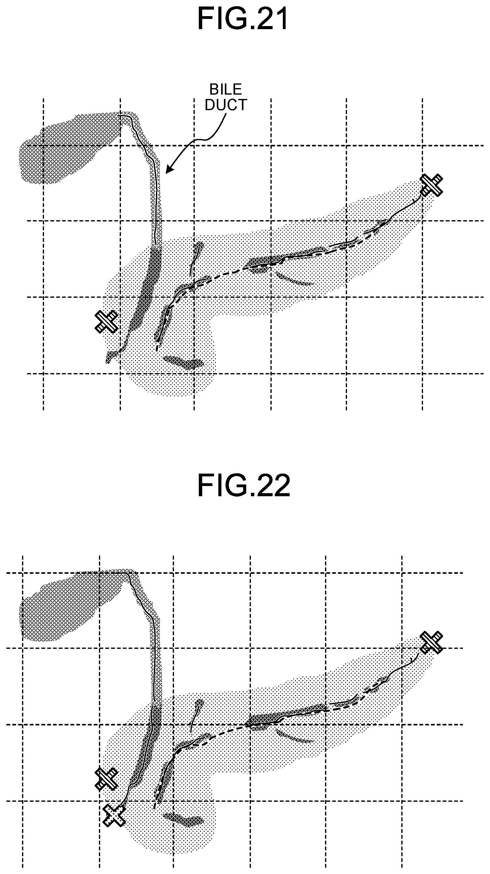 Patent US12569329 Figure 14 – Medical image processing apparatus, medical image processing method, and non-transitory computer-readable storage medium
