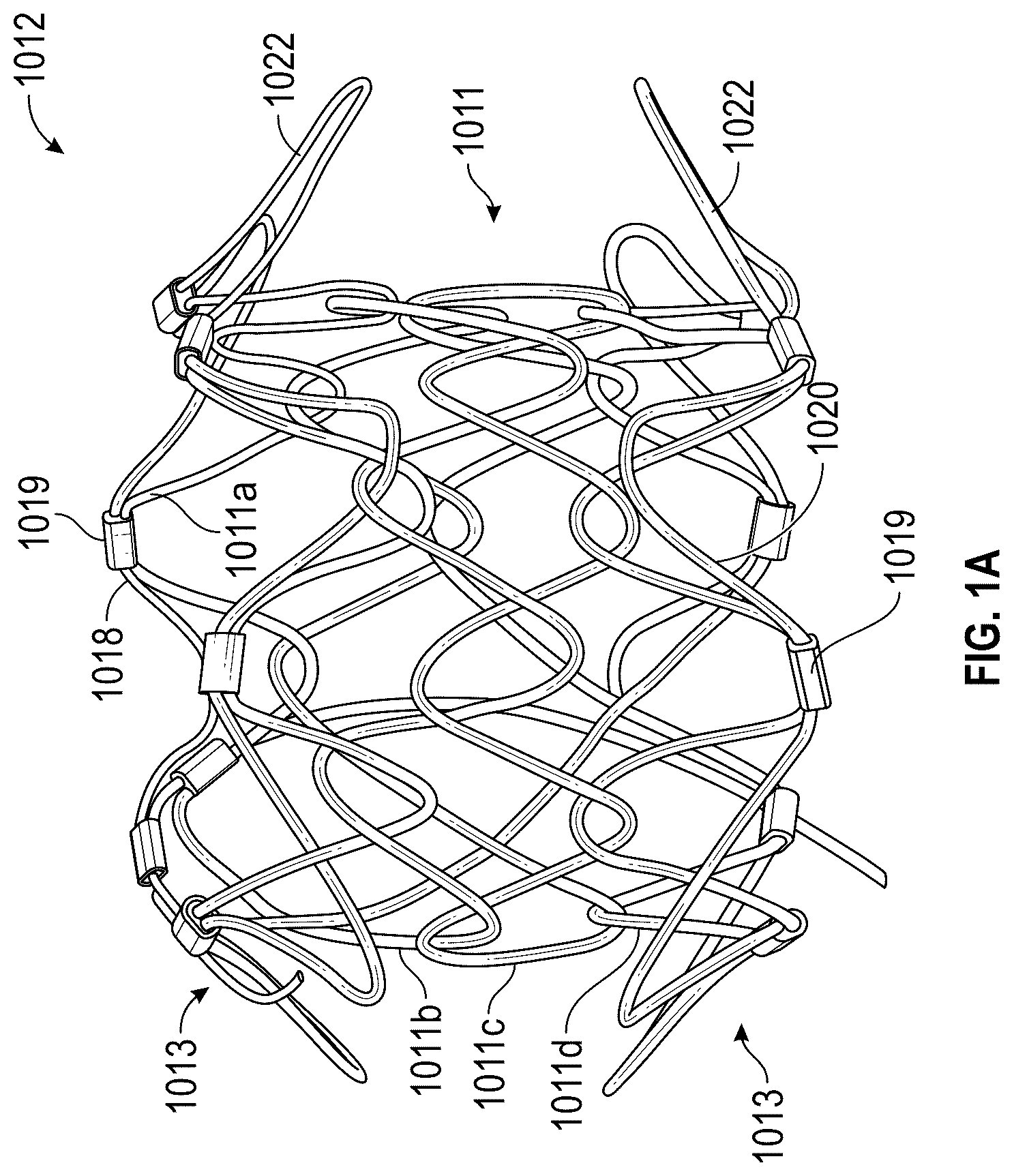 Patent US12569330 Figure 1 – Percutaneous Potts shunt devices and related methods