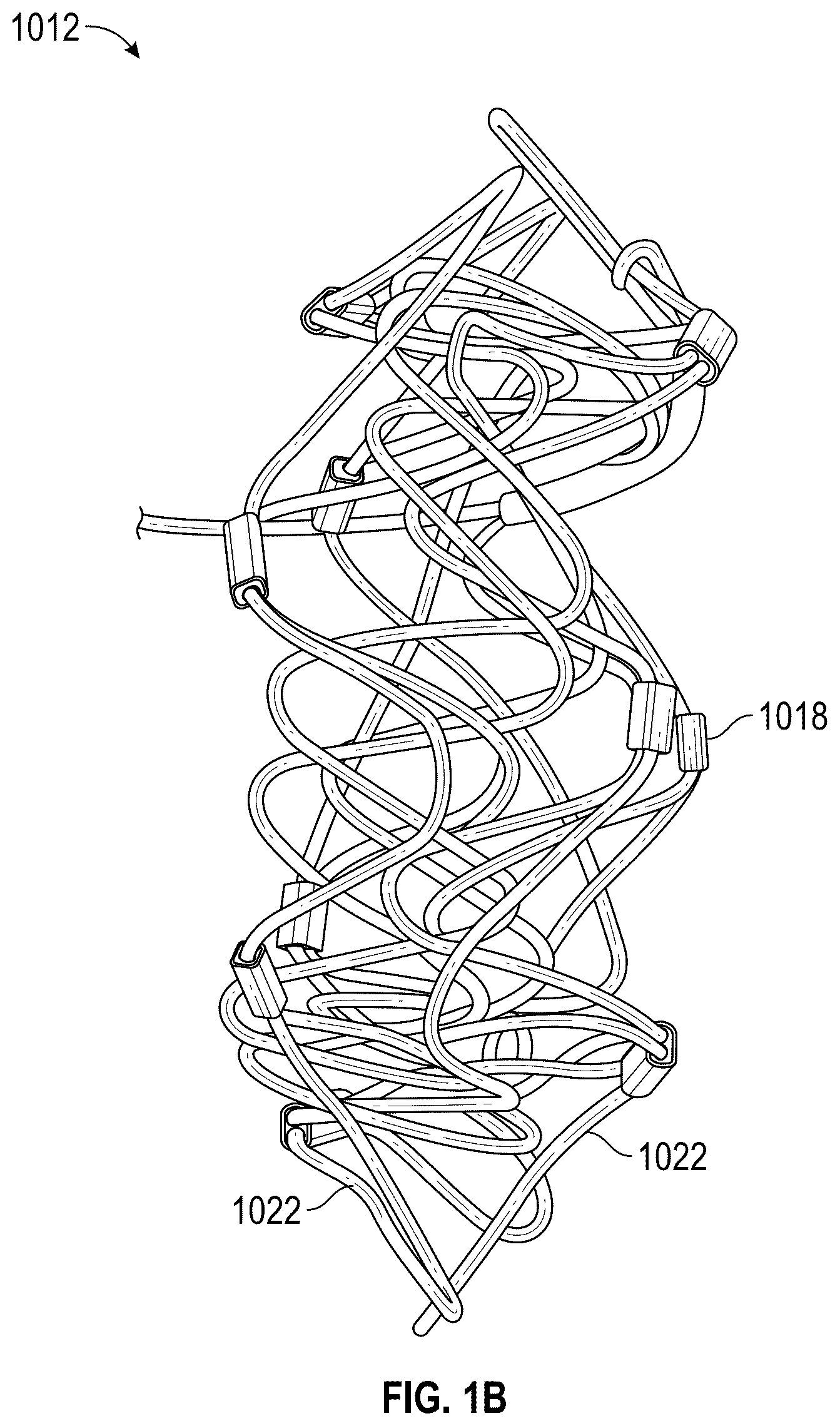 Patent US12569330 Figure 2 – Percutaneous Potts shunt devices and related methods