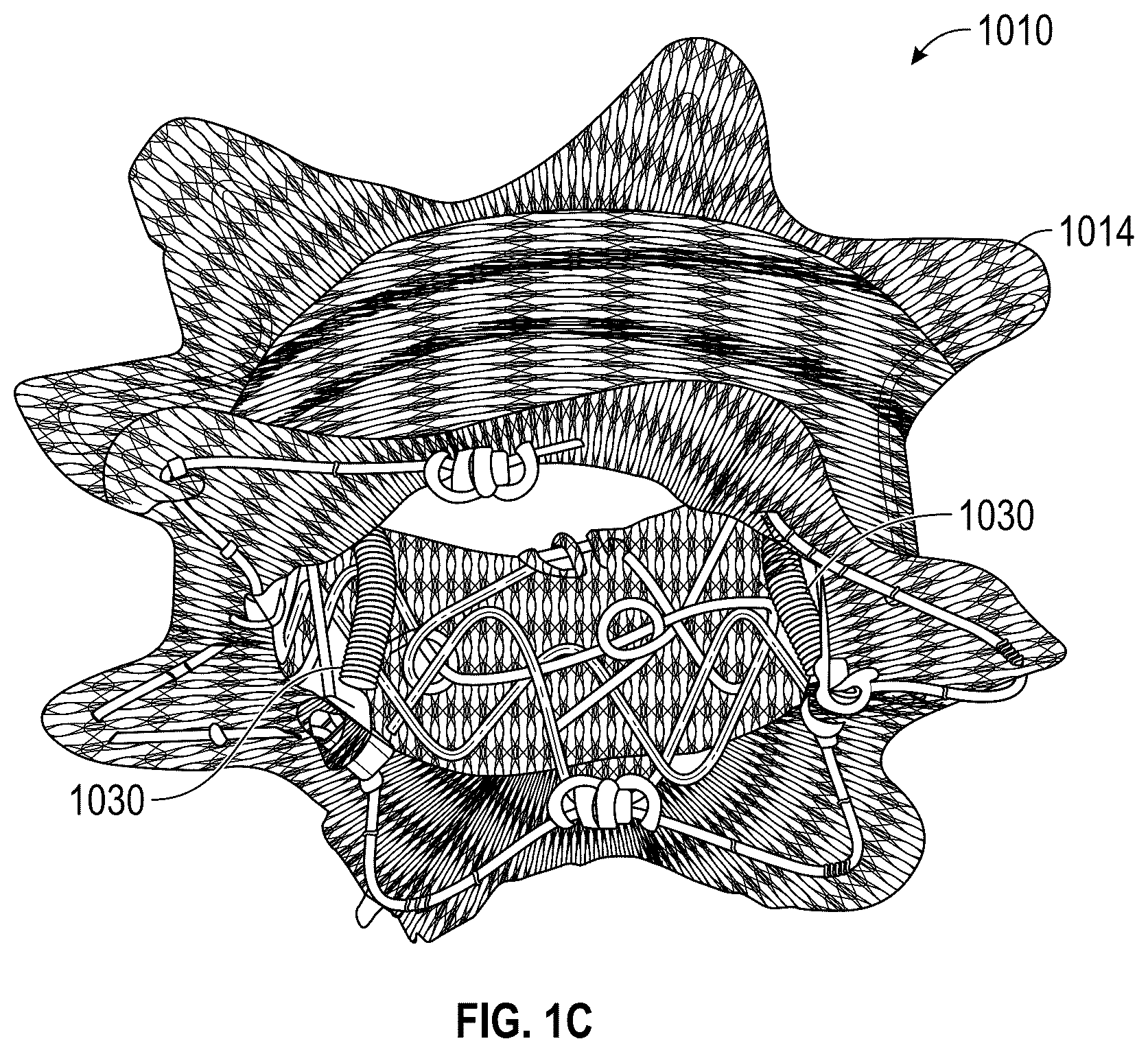 Patent US12569330 Figure 3 – Percutaneous Potts shunt devices and related methods