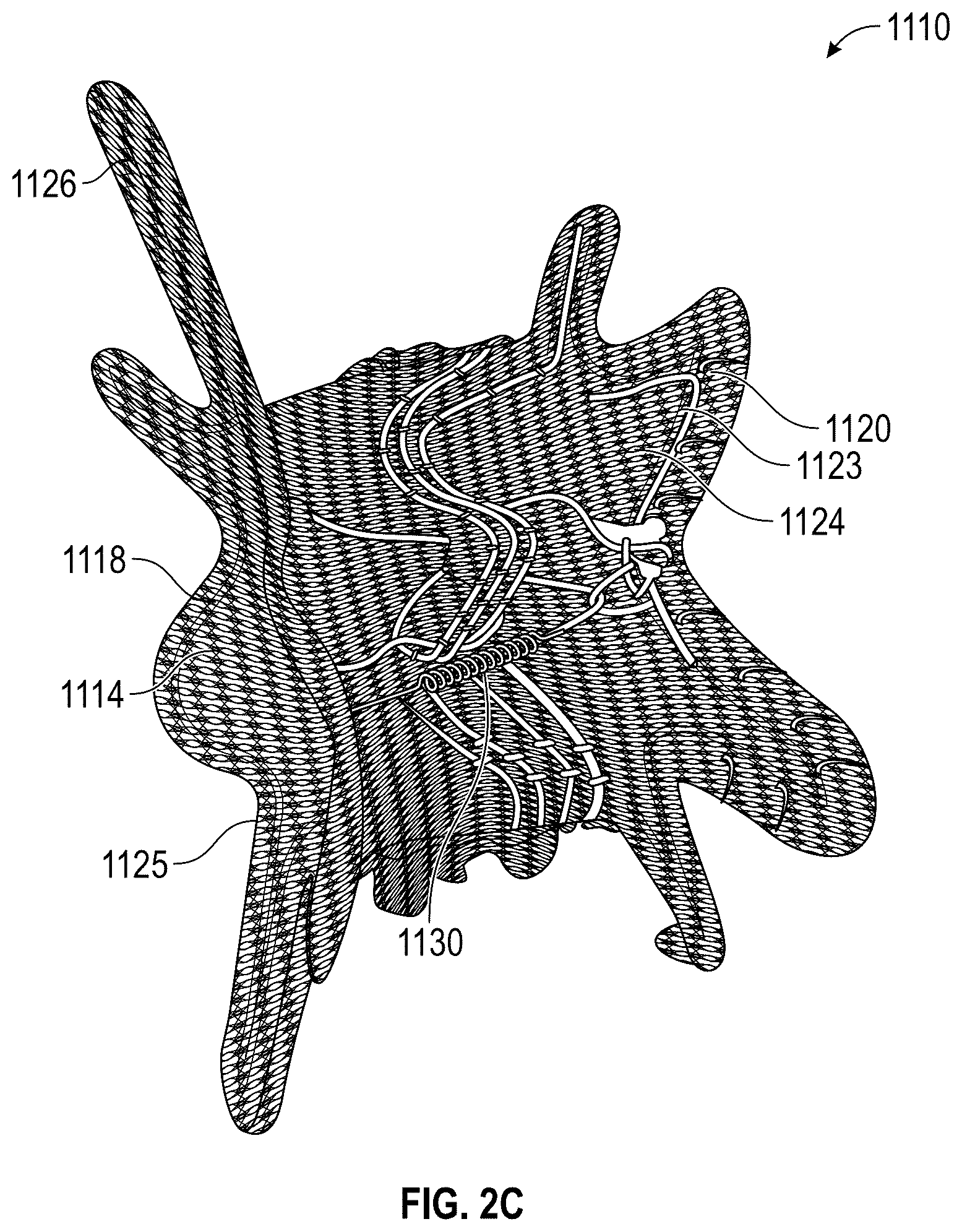 Patent US12569330 Figure 5 – Percutaneous Potts shunt devices and related methods