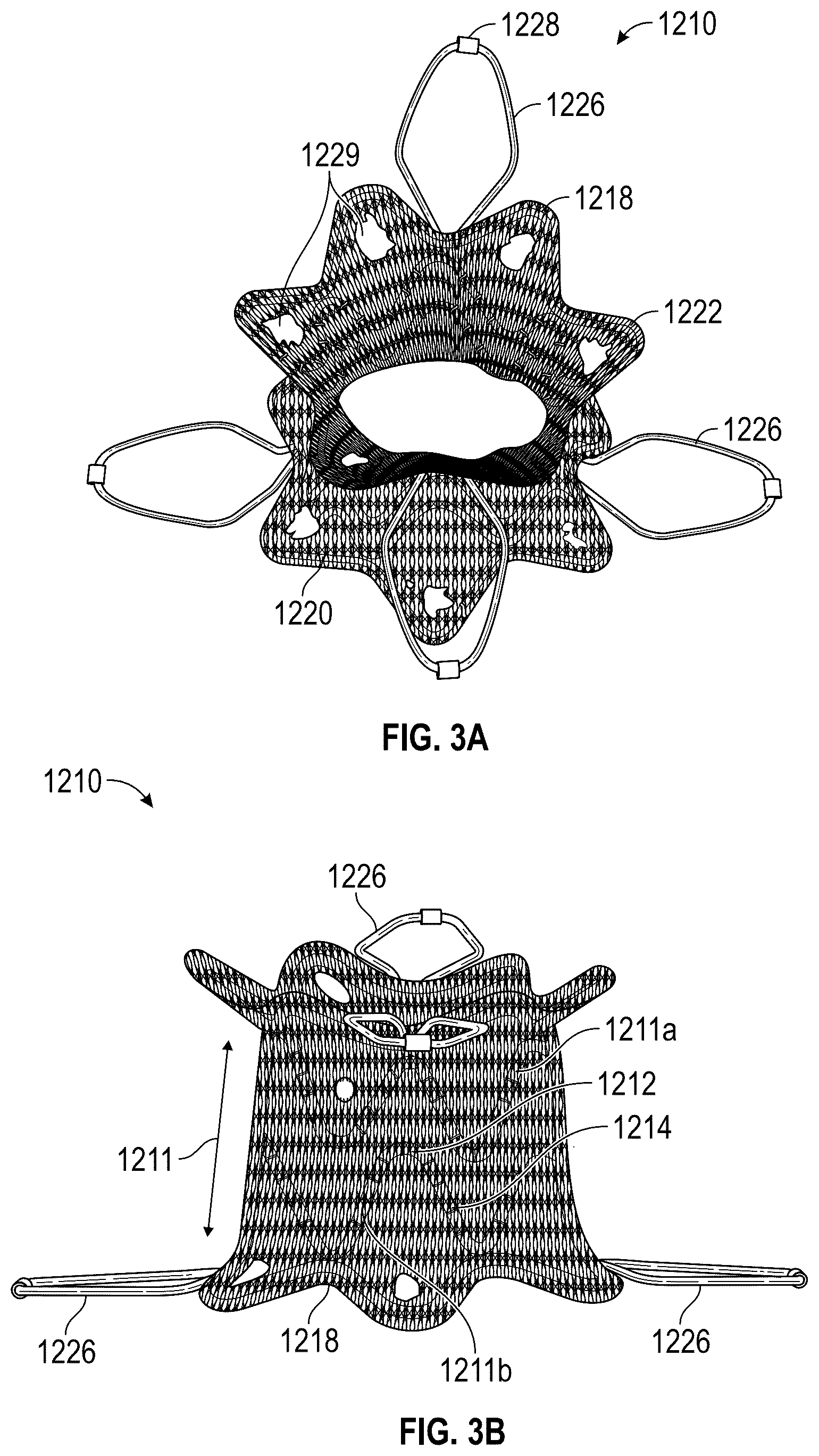 Patent US12569330 Figure 6 – Percutaneous Potts shunt devices and related methods