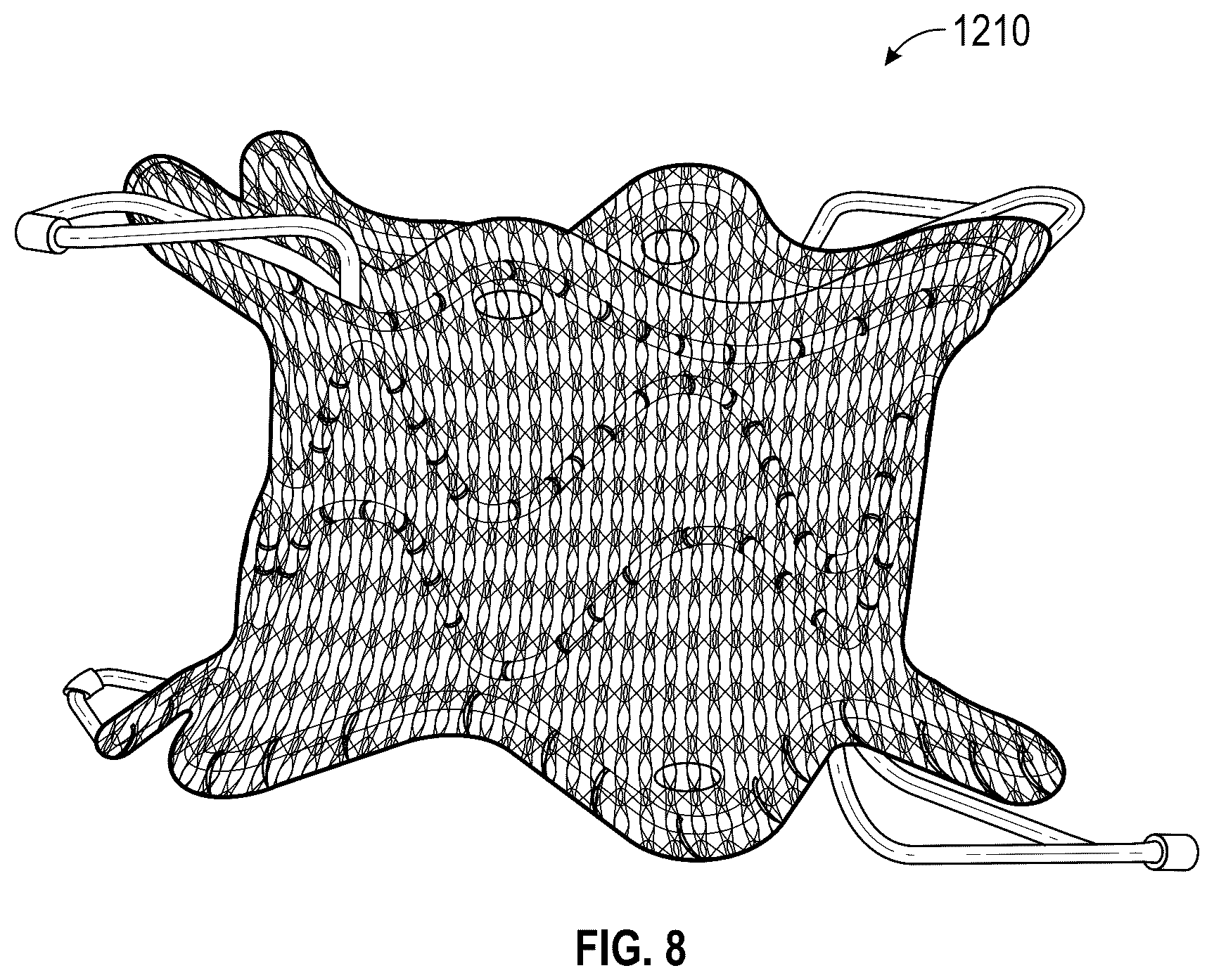 Patent US12569330 Figure 9 – Percutaneous Potts shunt devices and related methods