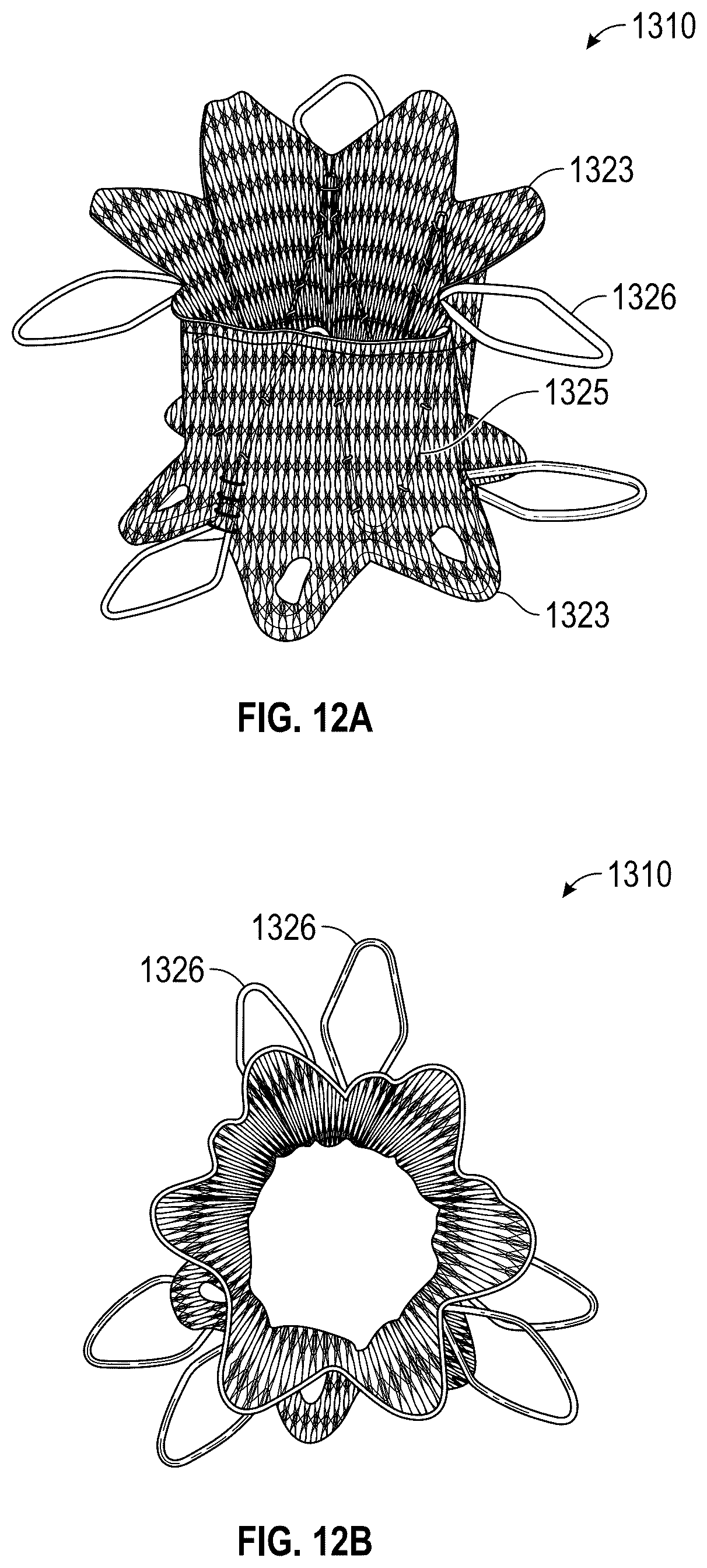 Patent US12569330 Figure 12 – Percutaneous Potts shunt devices and related methods