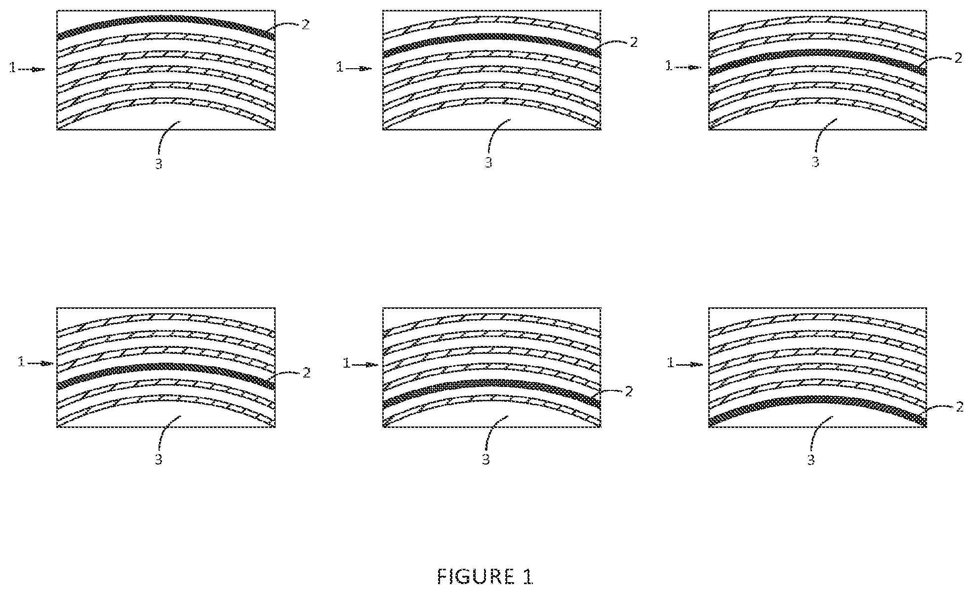 Patent US12569331 Figure 1 – Implant with a visual indicator of a barrier layer