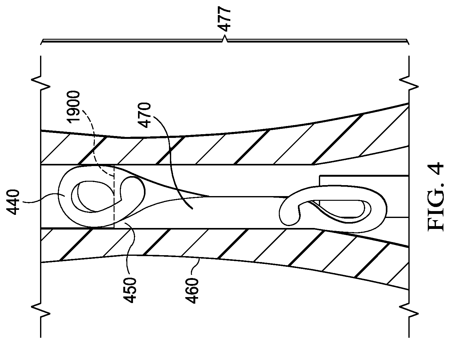 Patent US12569332 Figure 4 – IOL injector with automatic driver or assisted manual drive force