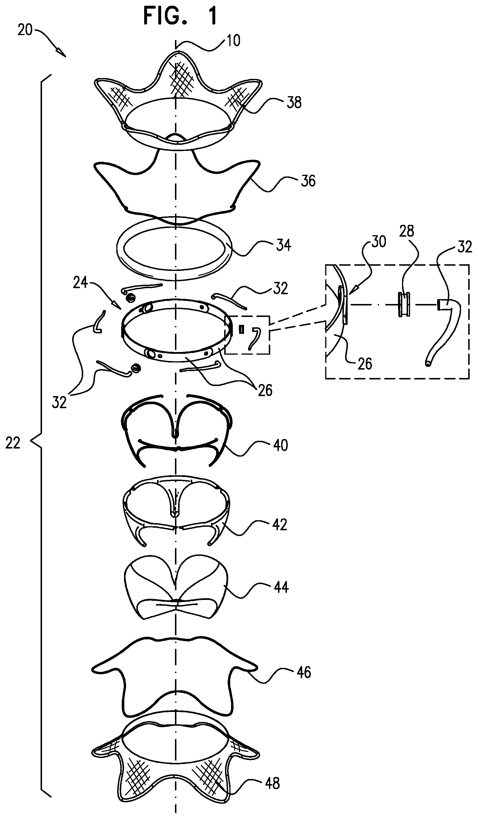 Patent US12569335 Figure 1 – Prosthetic heart valve with frames