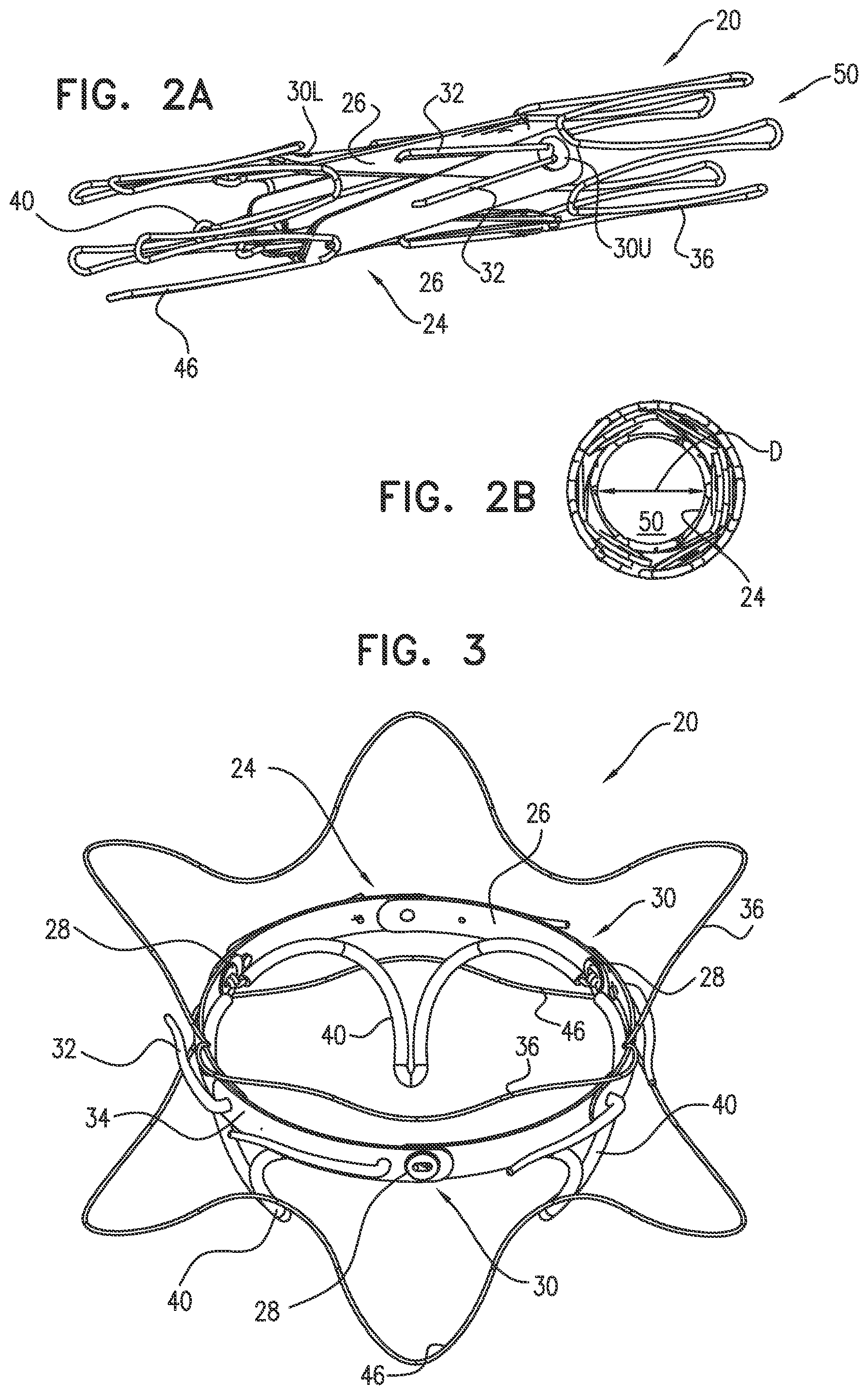 Patent US12569335 Figure 2 – Prosthetic heart valve with frames