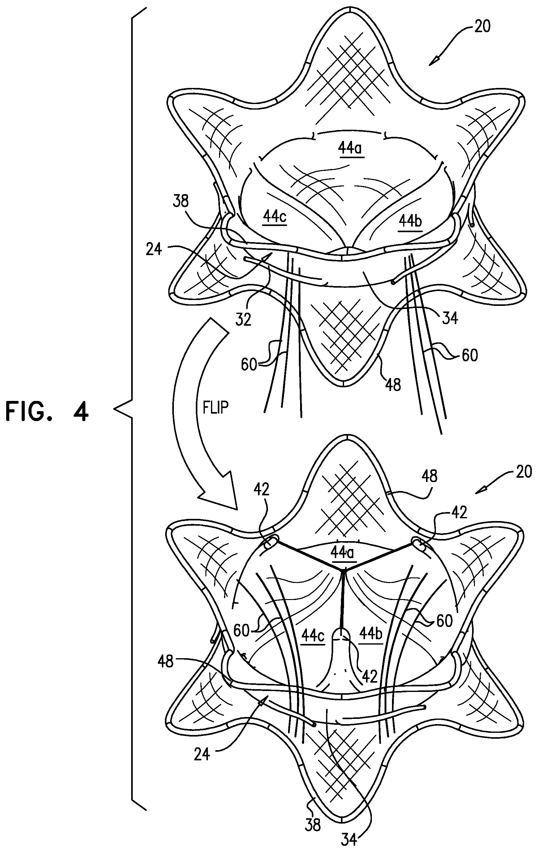 Patent US12569335 Figure 3 – Prosthetic heart valve with frames