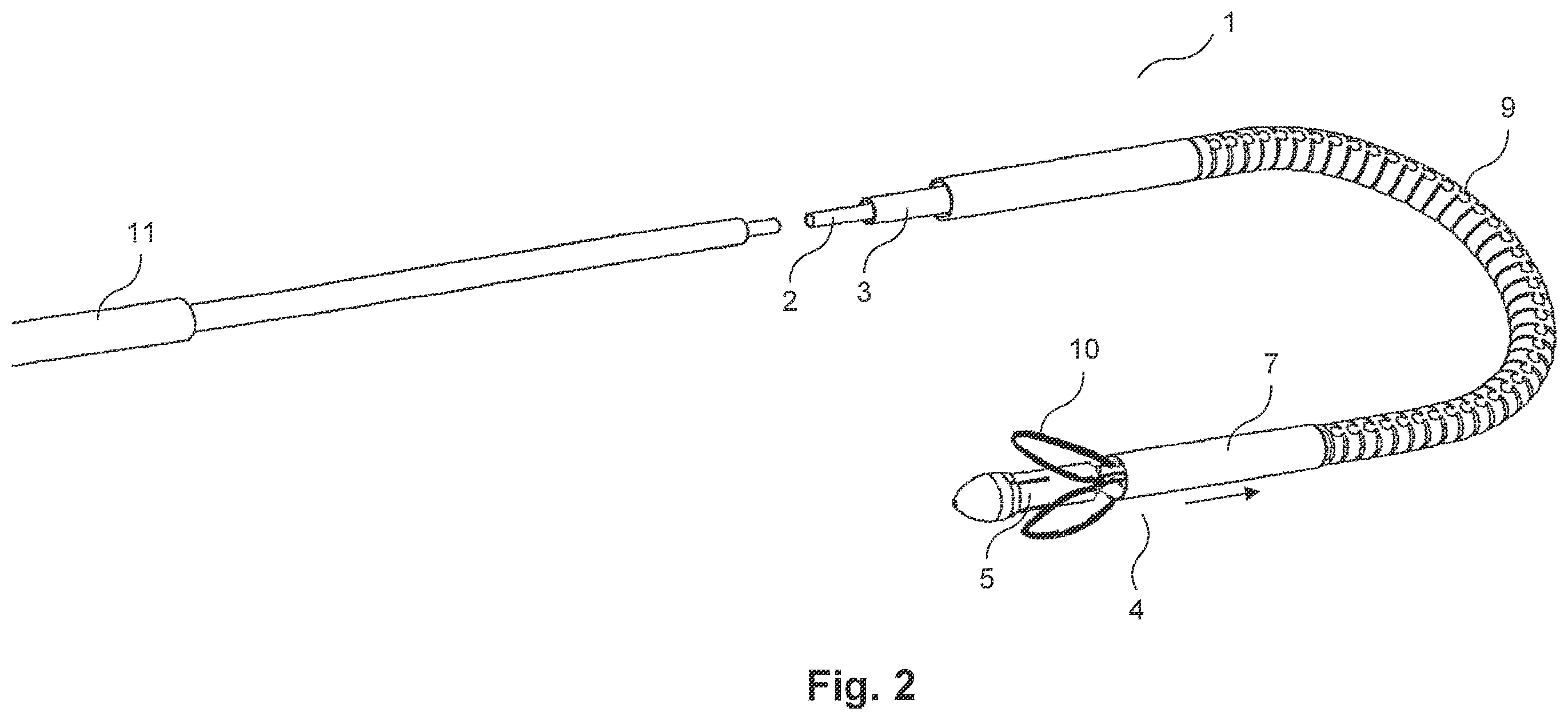 Patent US12569336 Figure 2 – Catheter system for implantation of prosthetic heart valves