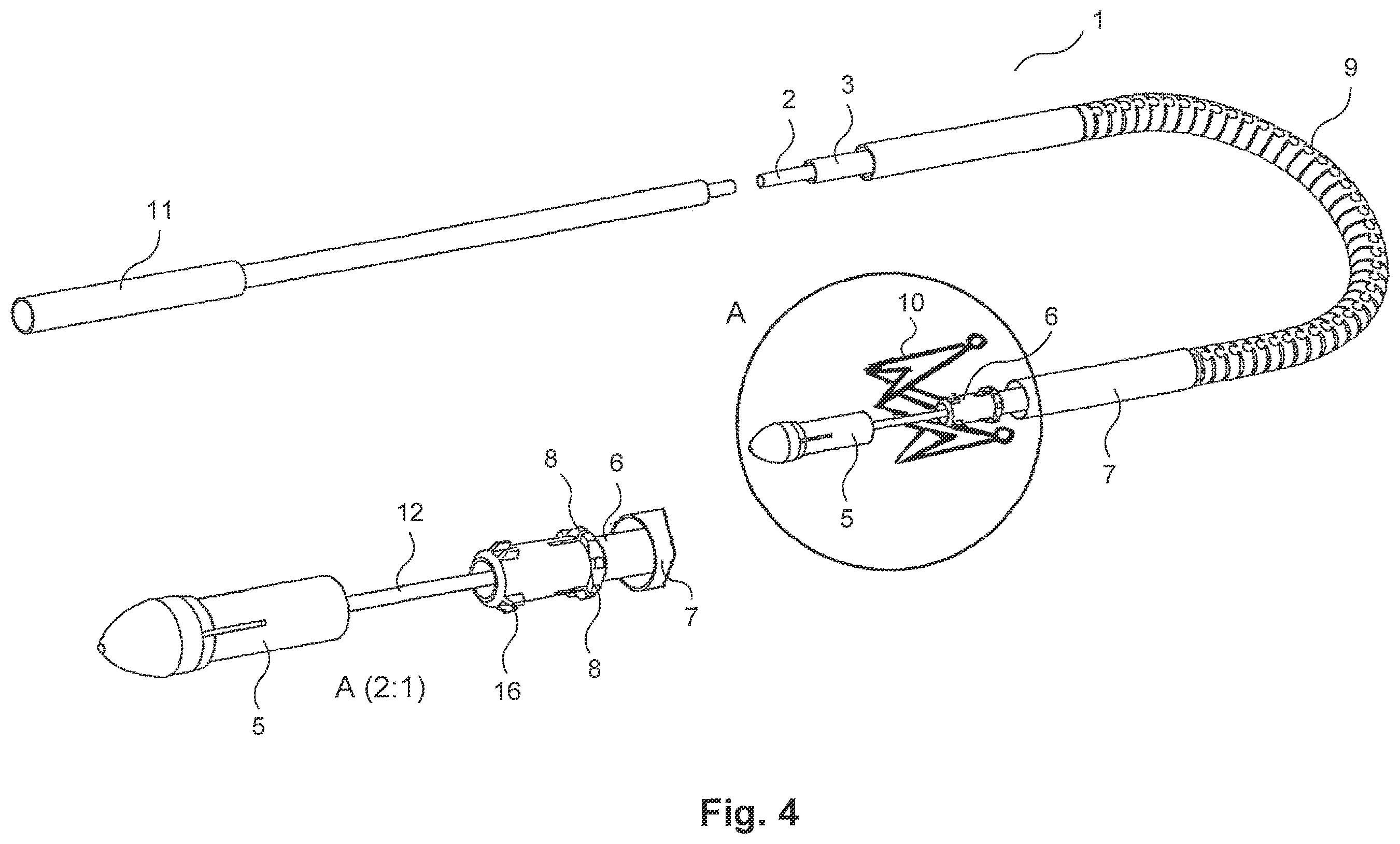 Patent US12569336 Figure 4 – Catheter system for implantation of prosthetic heart valves