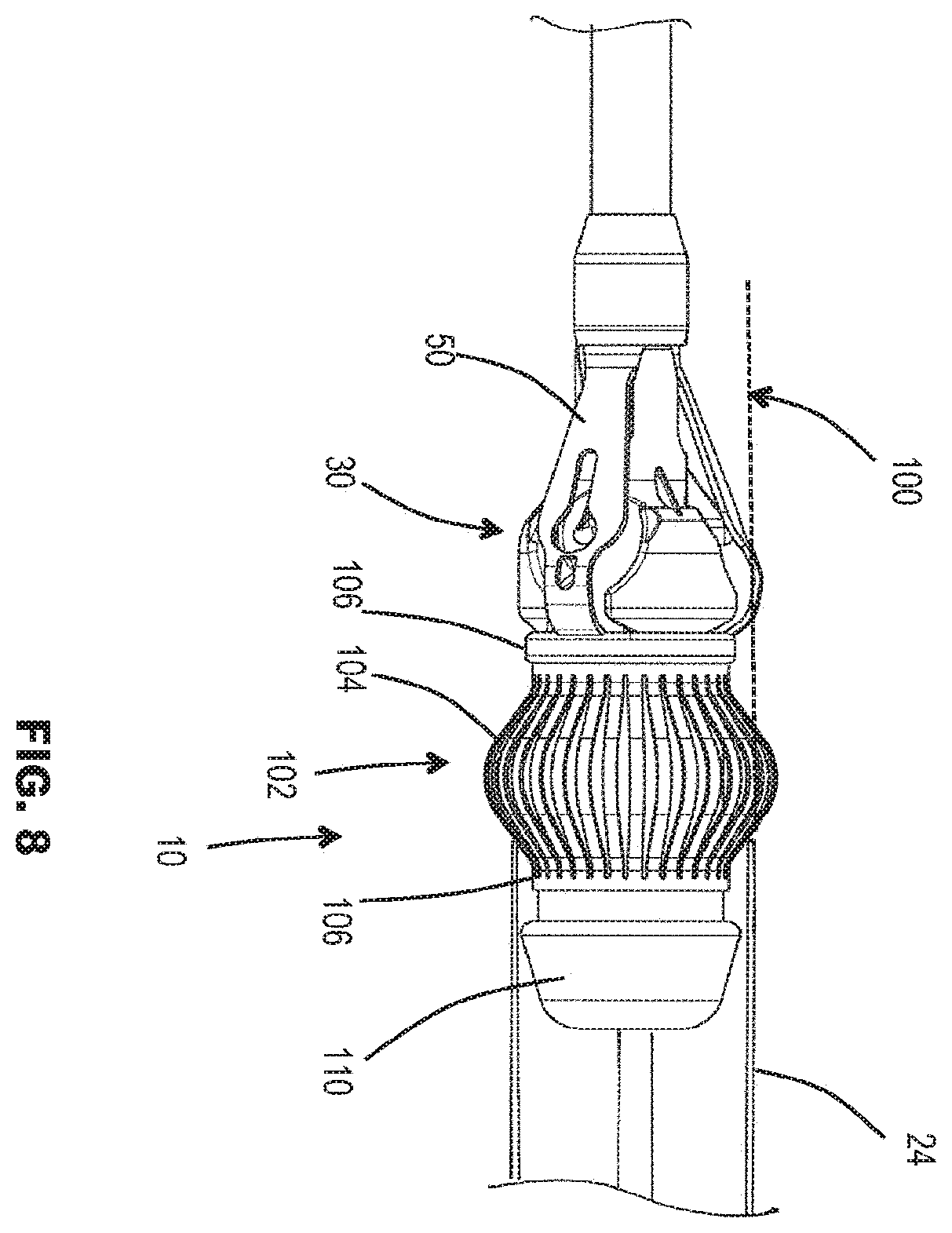 Patent US12569337 Figure 7 – Prosthetic valve, delivery apparatus and delivery method