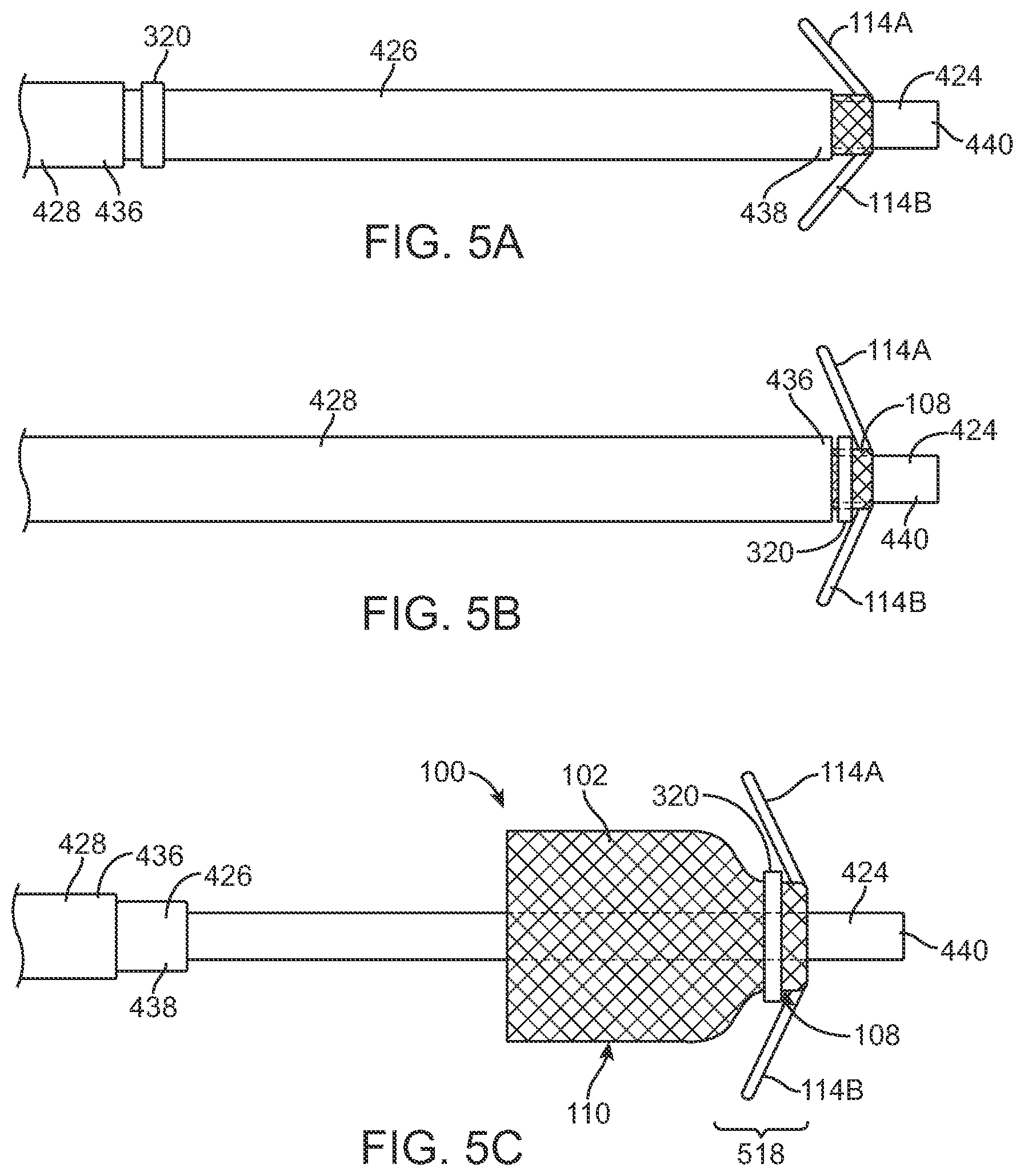 Patent US12569340 Figure 4 – Transcatheter valve prosthesis and a concurrently delivered sealing component