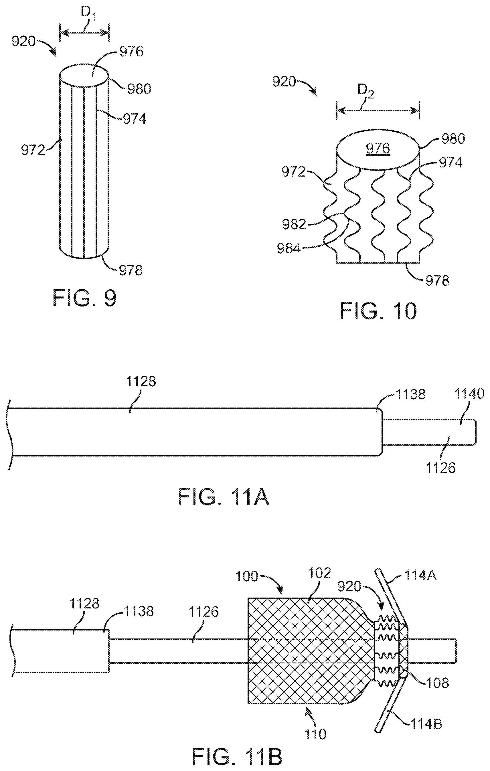 Patent US12569340 Figure 6 – Transcatheter valve prosthesis and a concurrently delivered sealing component