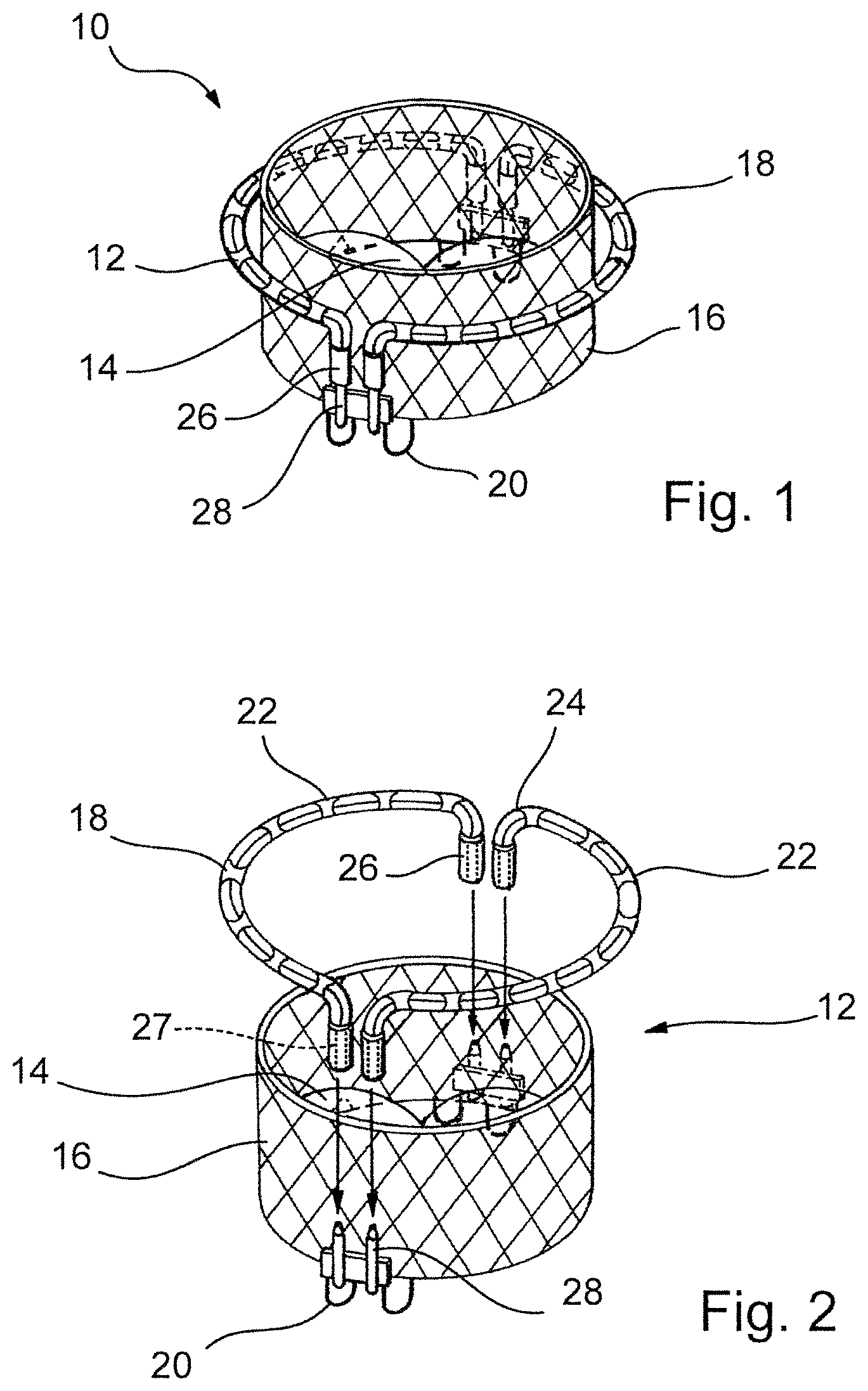 Patent US12569341 — Device for arranging guidewires around a heart valve — Figure 1