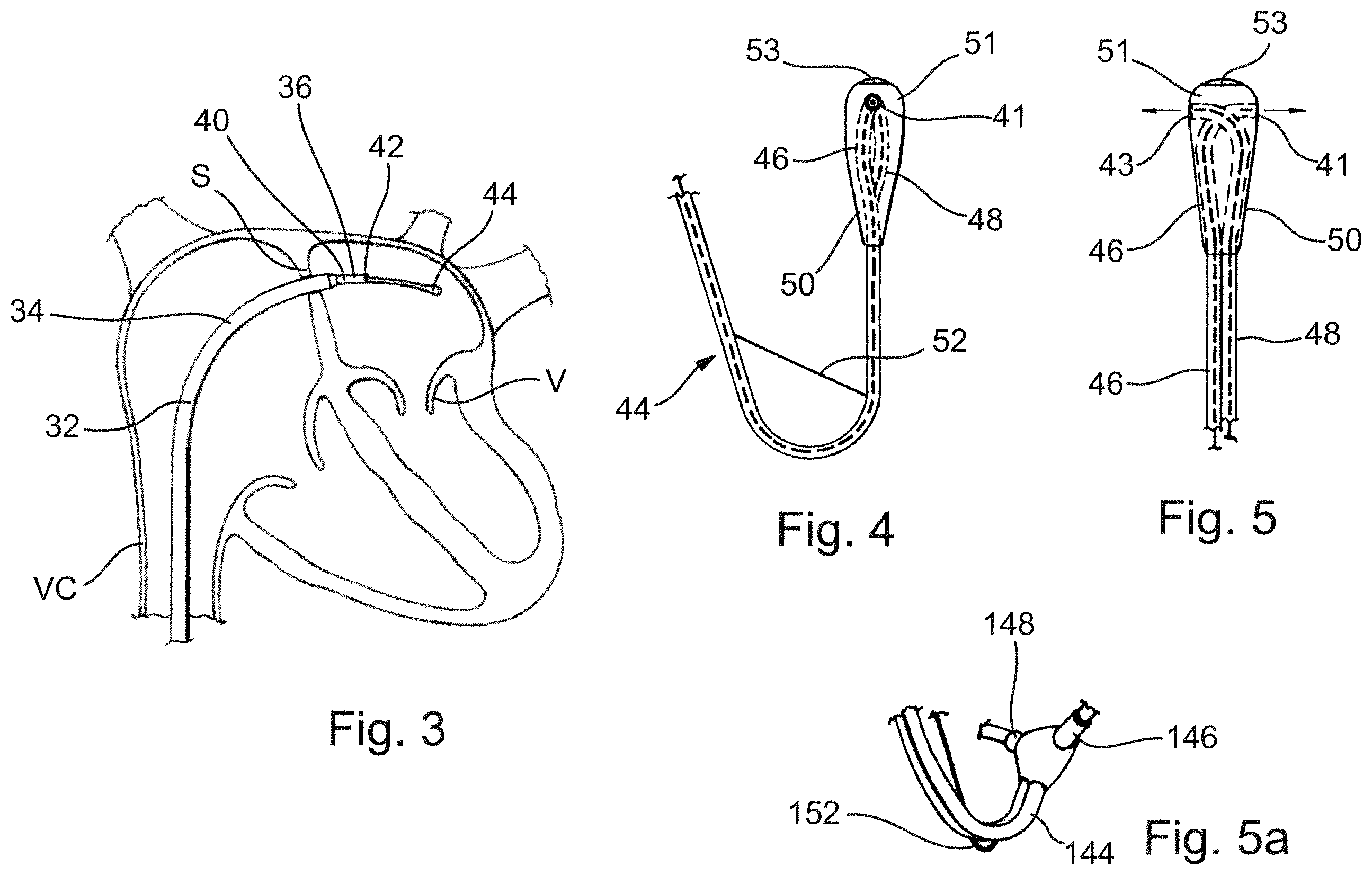 Patent US12569341 Figure 2 – Device for arranging guidewires around a heart valve