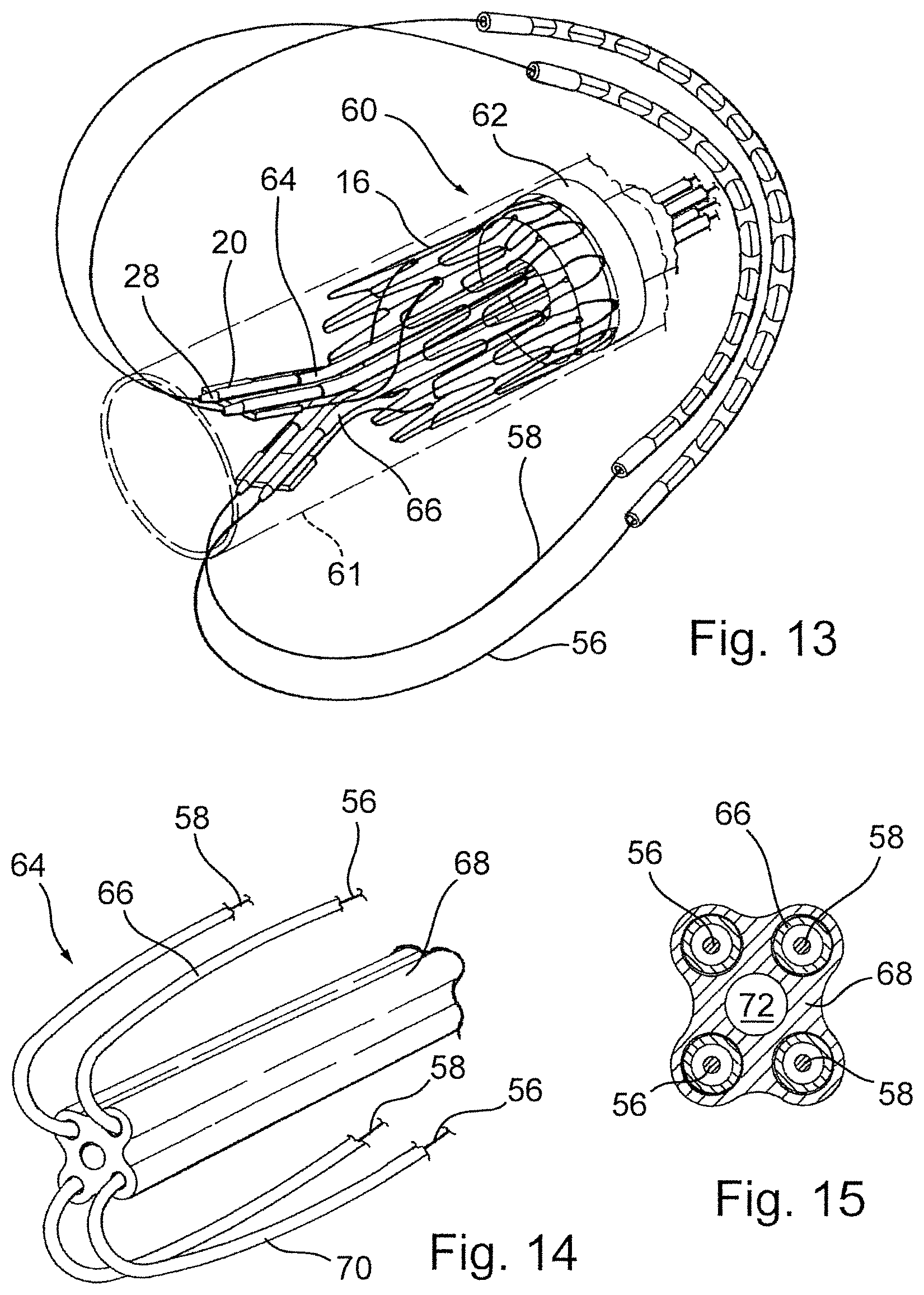 Patent US12569341 Figure 9 – Device for arranging guidewires around a heart valve