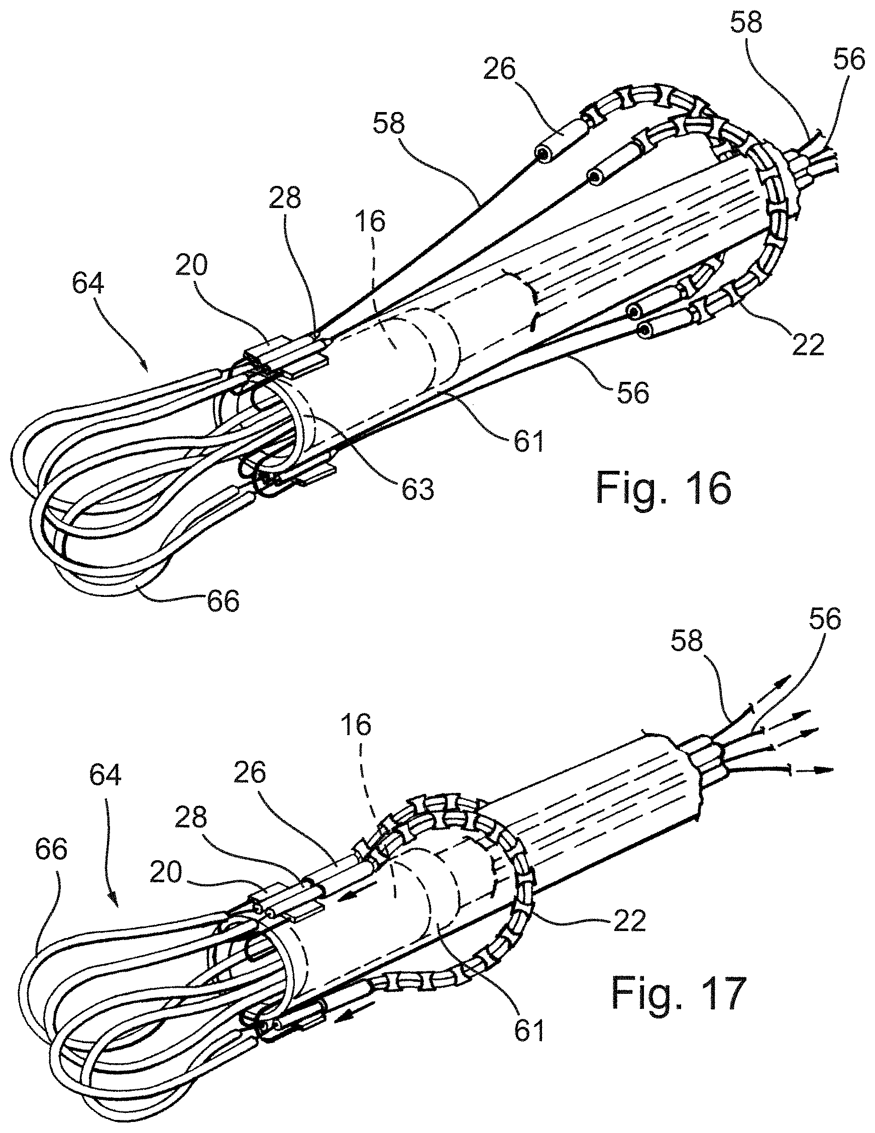 Patent US12569341 Figure 10 – Device for arranging guidewires around a heart valve