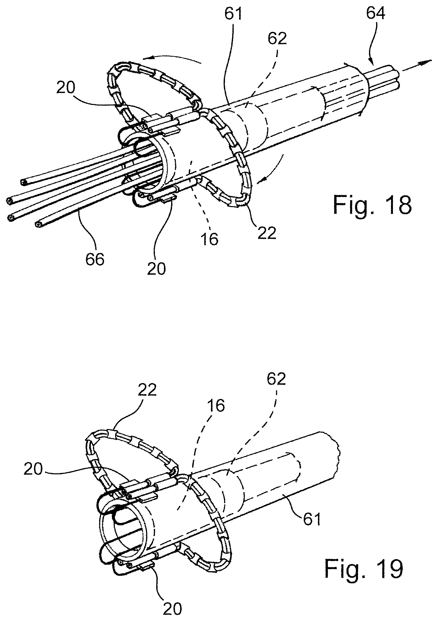 Patent US12569341 Figure 11 – Device for arranging guidewires around a heart valve