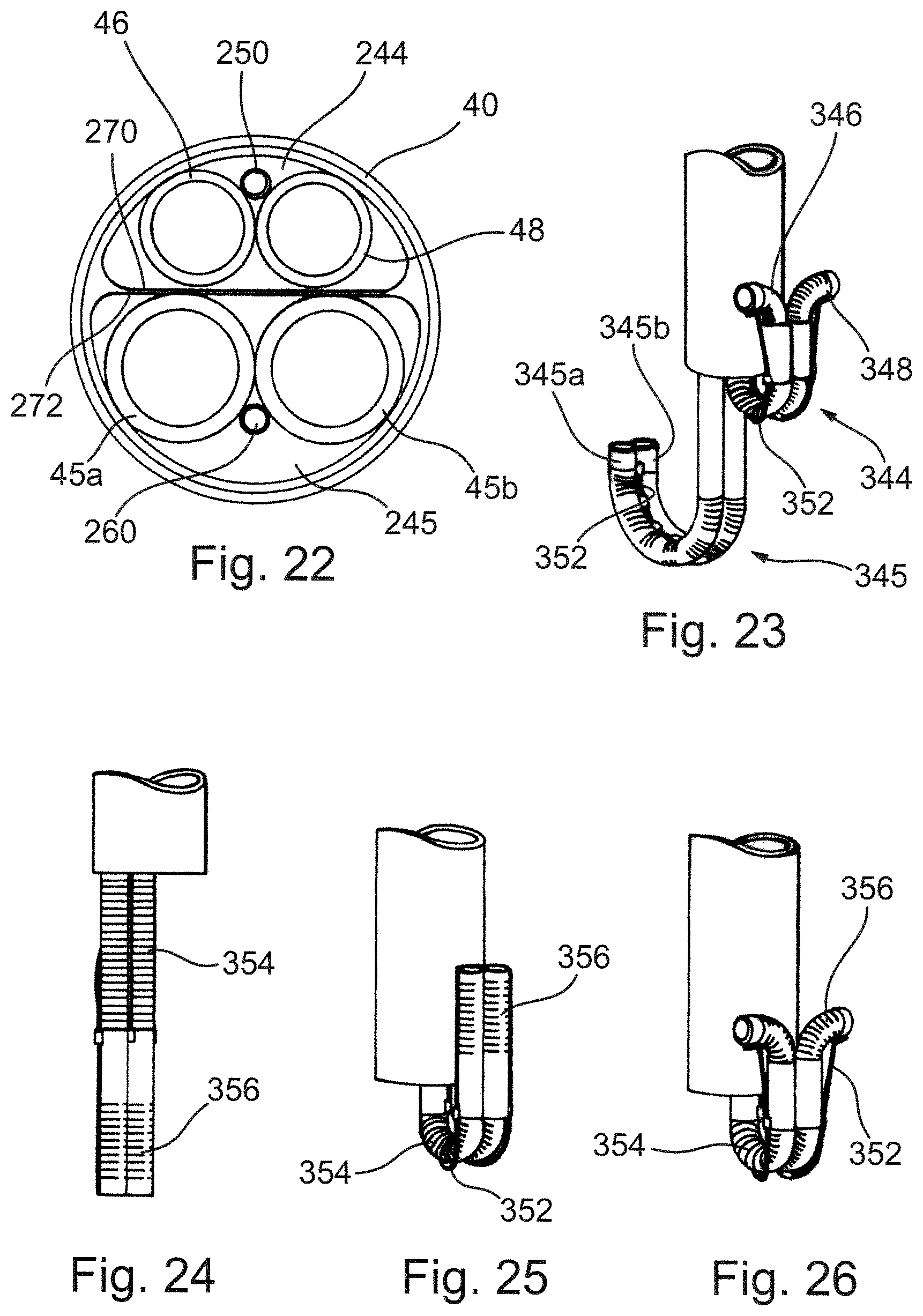 Patent US12569341 Figure 14 – Device for arranging guidewires around a heart valve