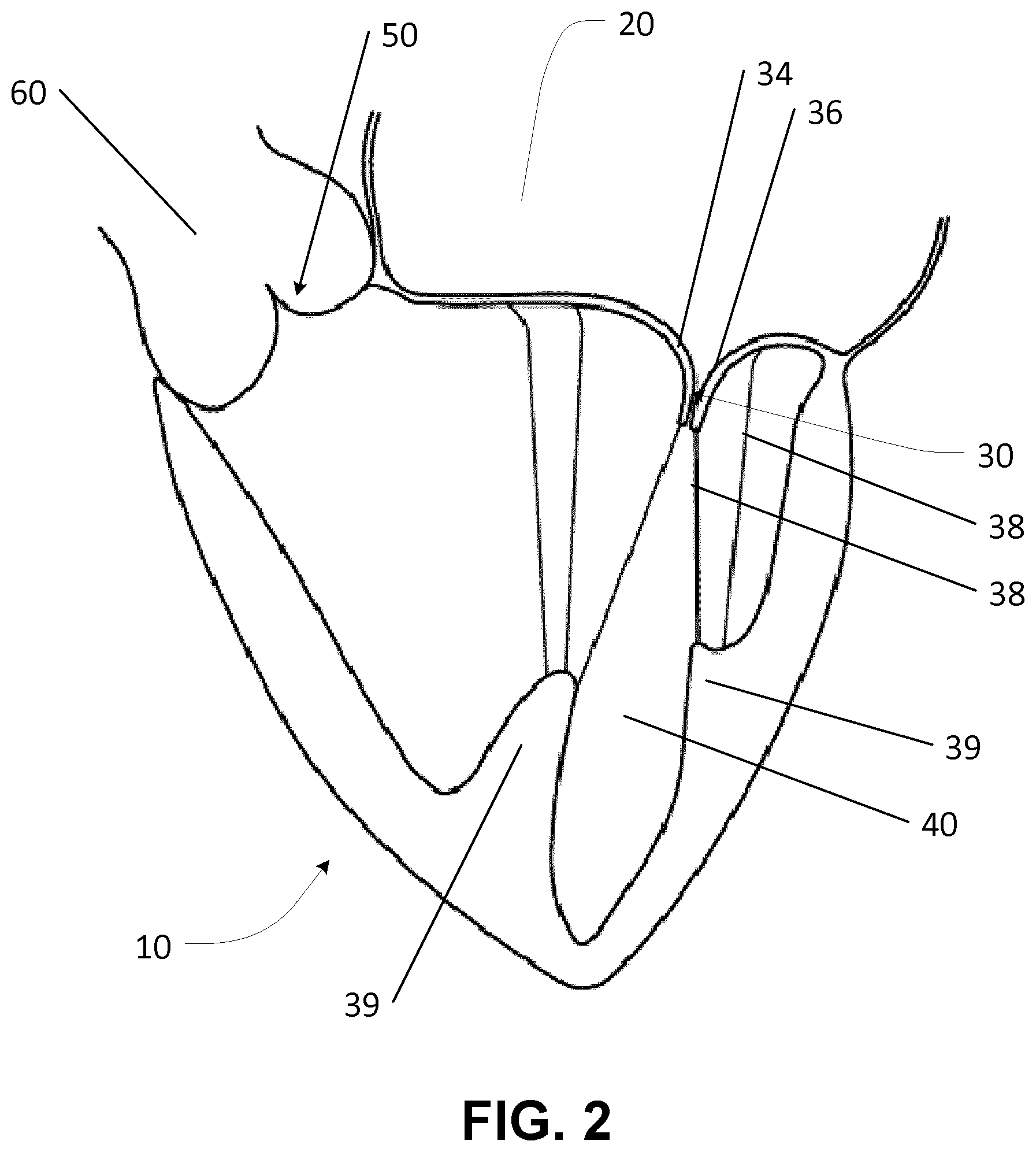 Patent US12569342 Figure 2 – Apparatus and methods for clamping a mitral valve